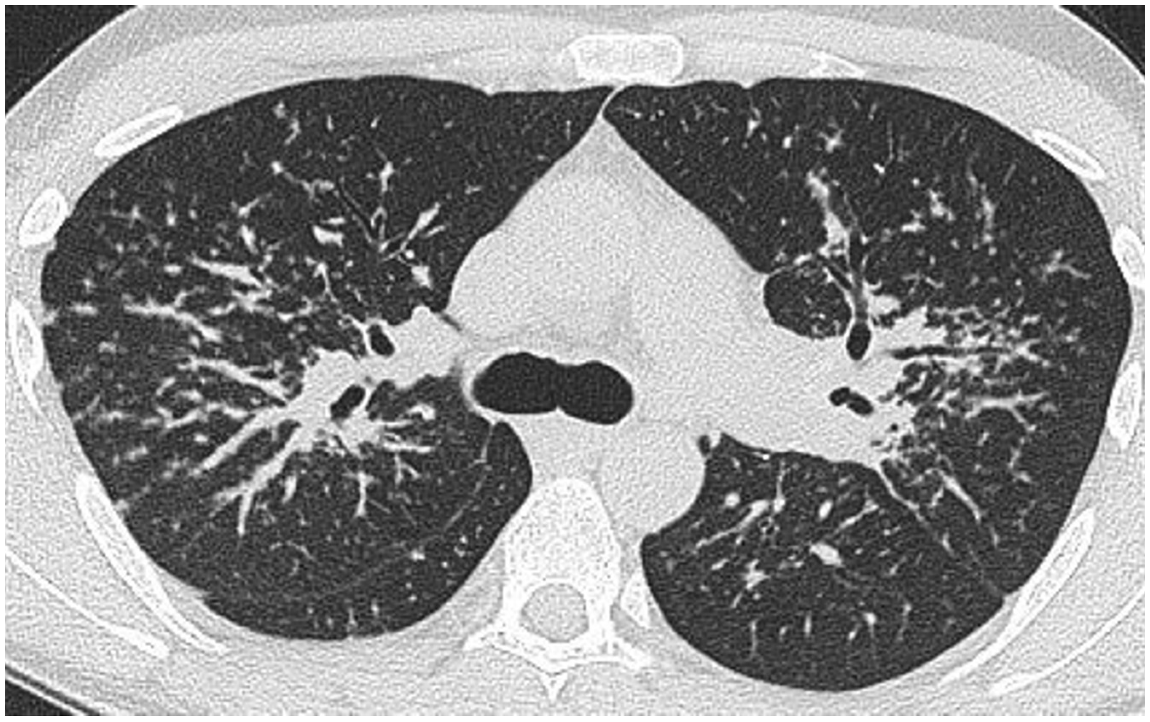 Jcm 13 00822 g002 Jcm 13 00822 g002