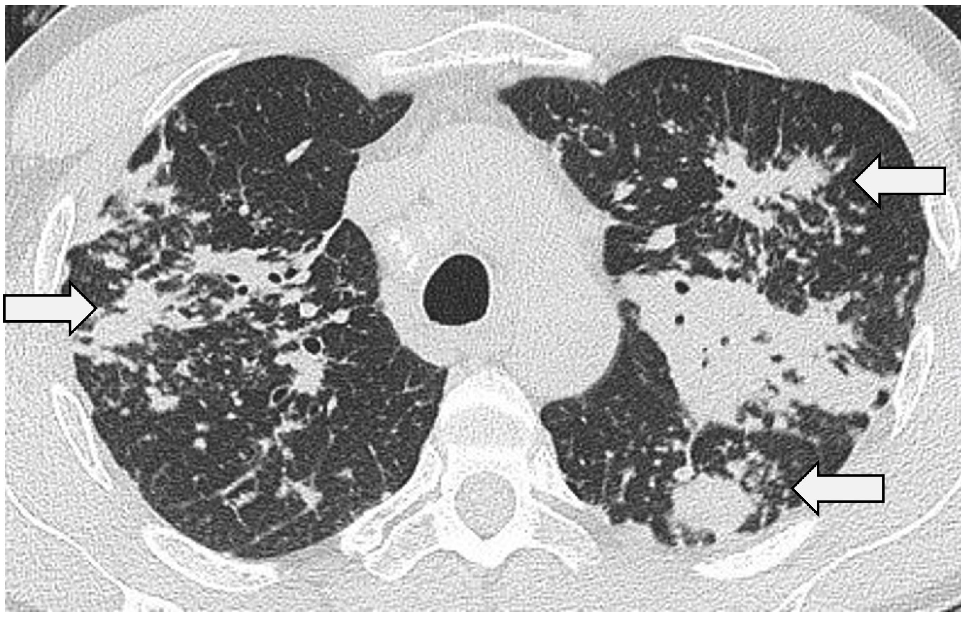 Jcm 13 00822 g003 Jcm 13 00822 g003