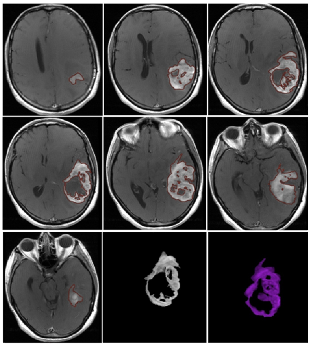 Jcm 13 00849 g001 Jcm 13 00849 g001