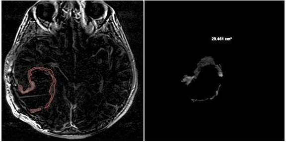 Jcm 13 00849 g003 Jcm 13 00849 g003