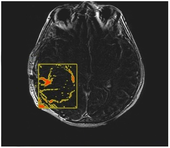 Jcm 13 00849 g004 Jcm 13 00849 g004