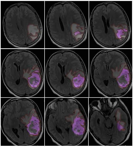 Jcm 13 00849 g005 Jcm 13 00849 g005