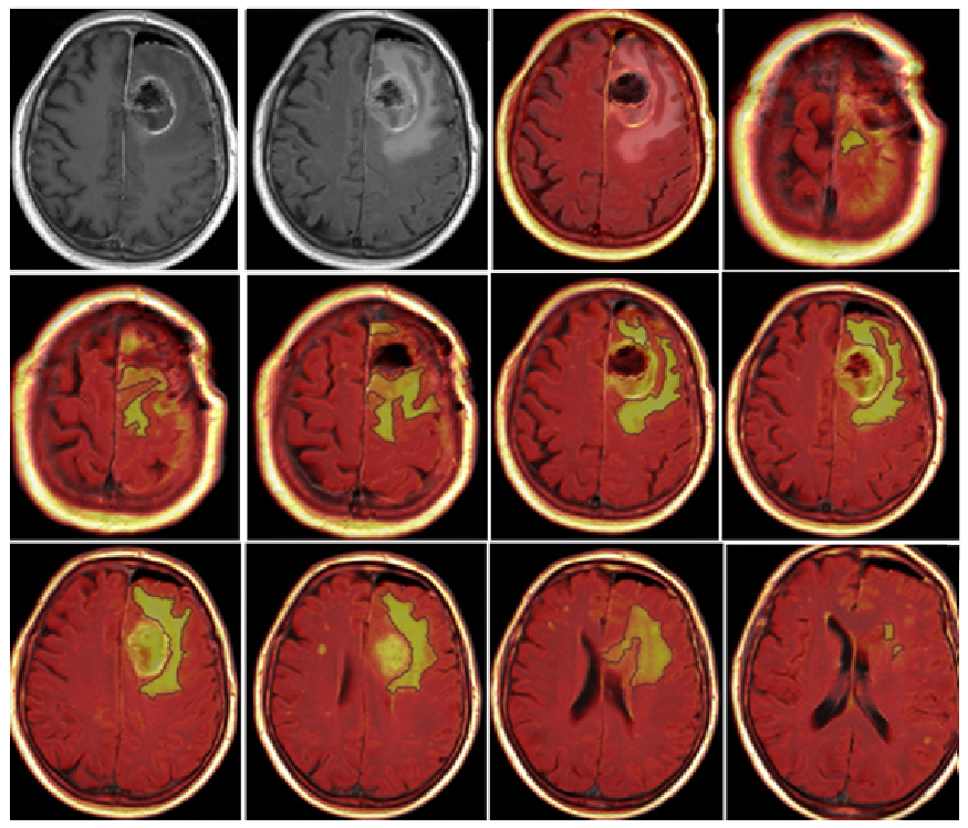 Jcm 13 00849 g006 Jcm 13 00849 g006