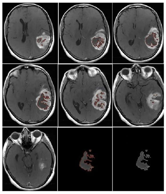 Jcm 13 00849 g007 Jcm 13 00849 g007