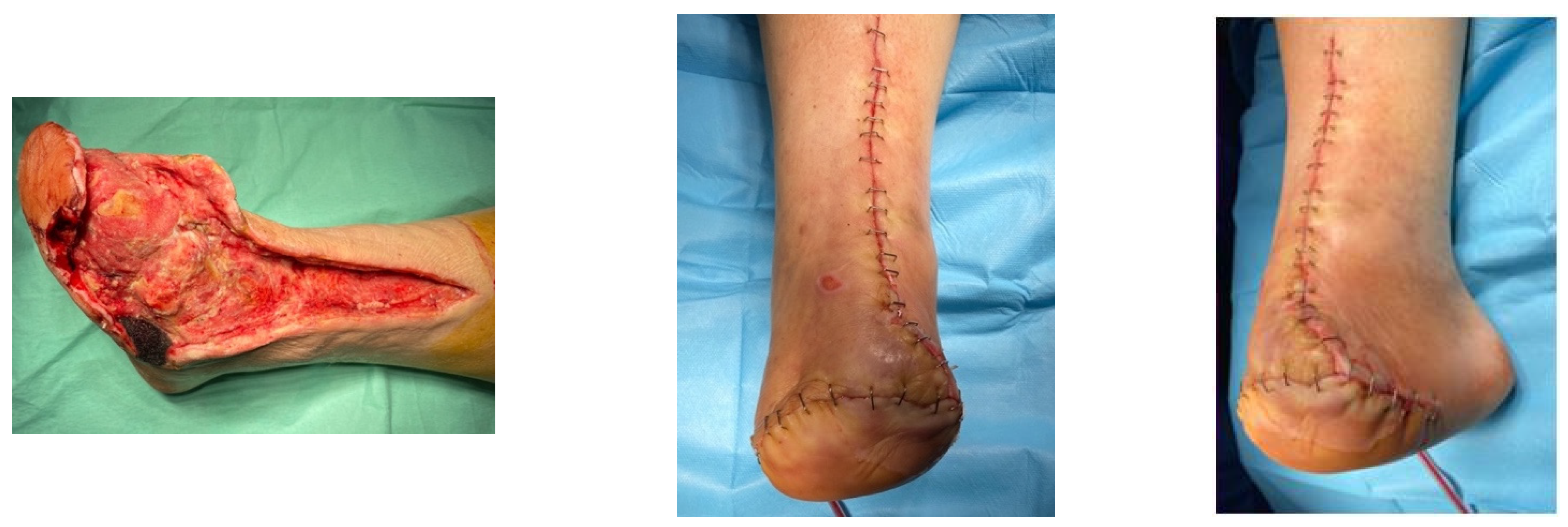 Jcm 13 00883 g015 Jcm 13 00883 g015