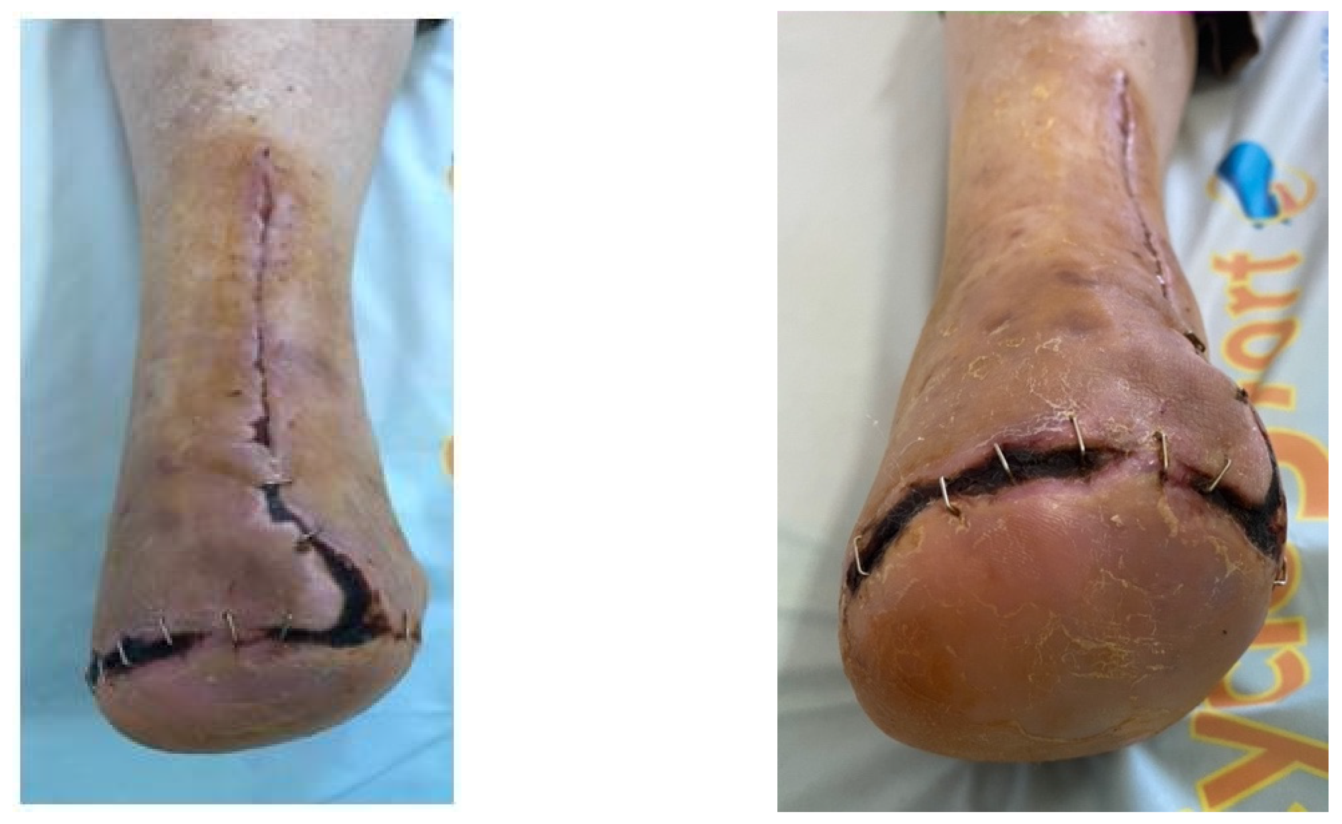 Jcm 13 00883 g017 Jcm 13 00883 g017