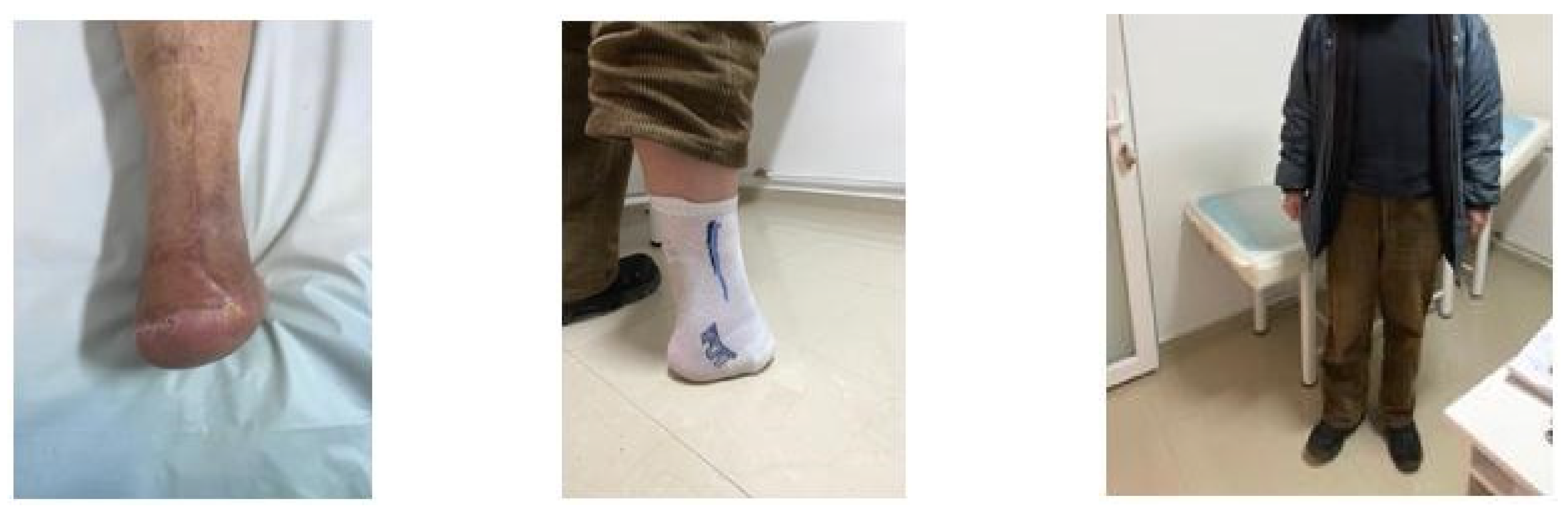 Jcm 13 00883 g018 Jcm 13 00883 g018