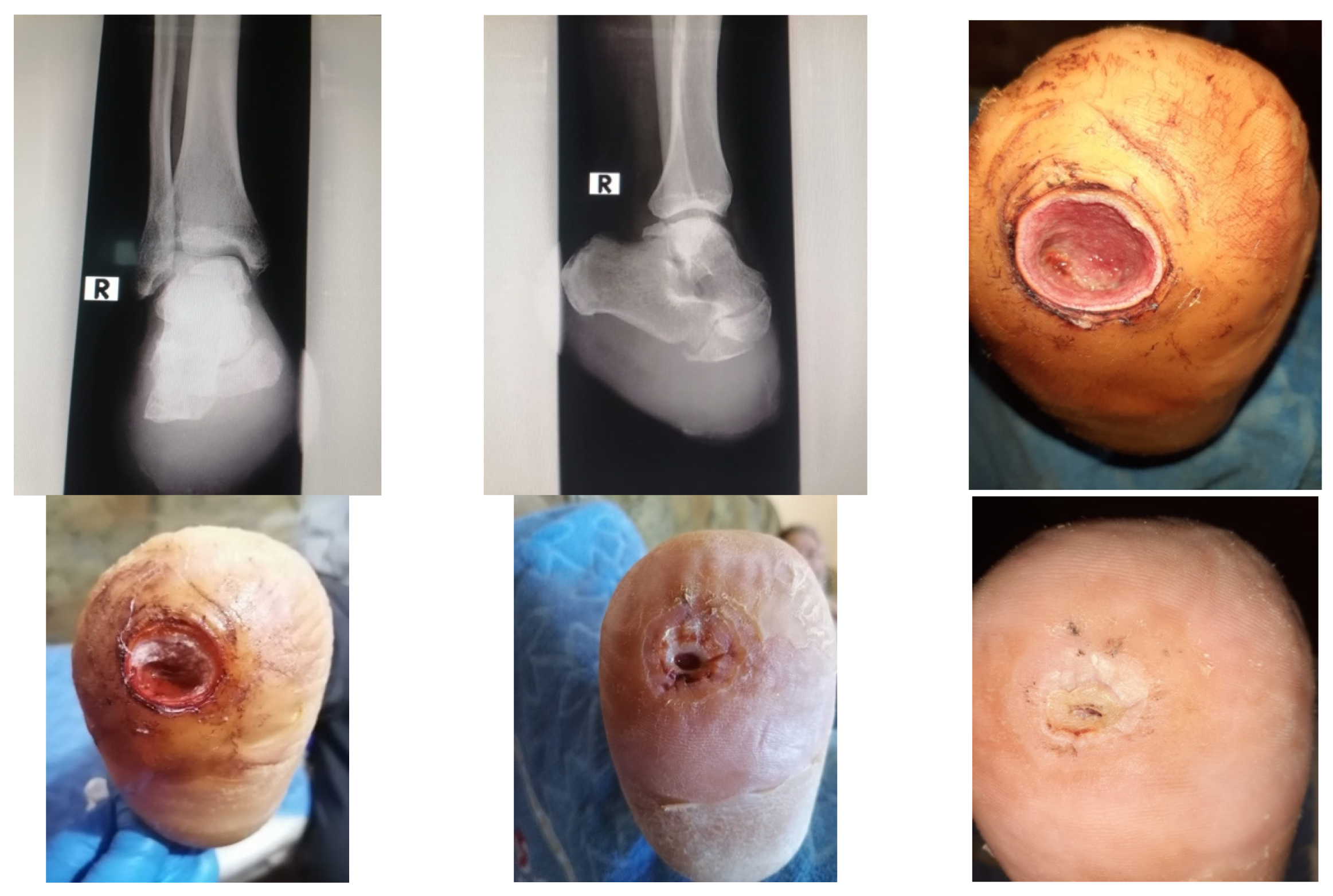 Jcm 13 00883 g019 Jcm 13 00883 g019