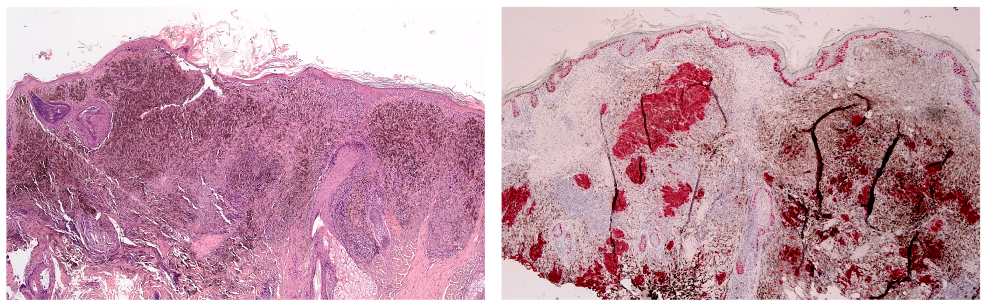 Jcm 13 00894 g004 Jcm 13 00894 g004