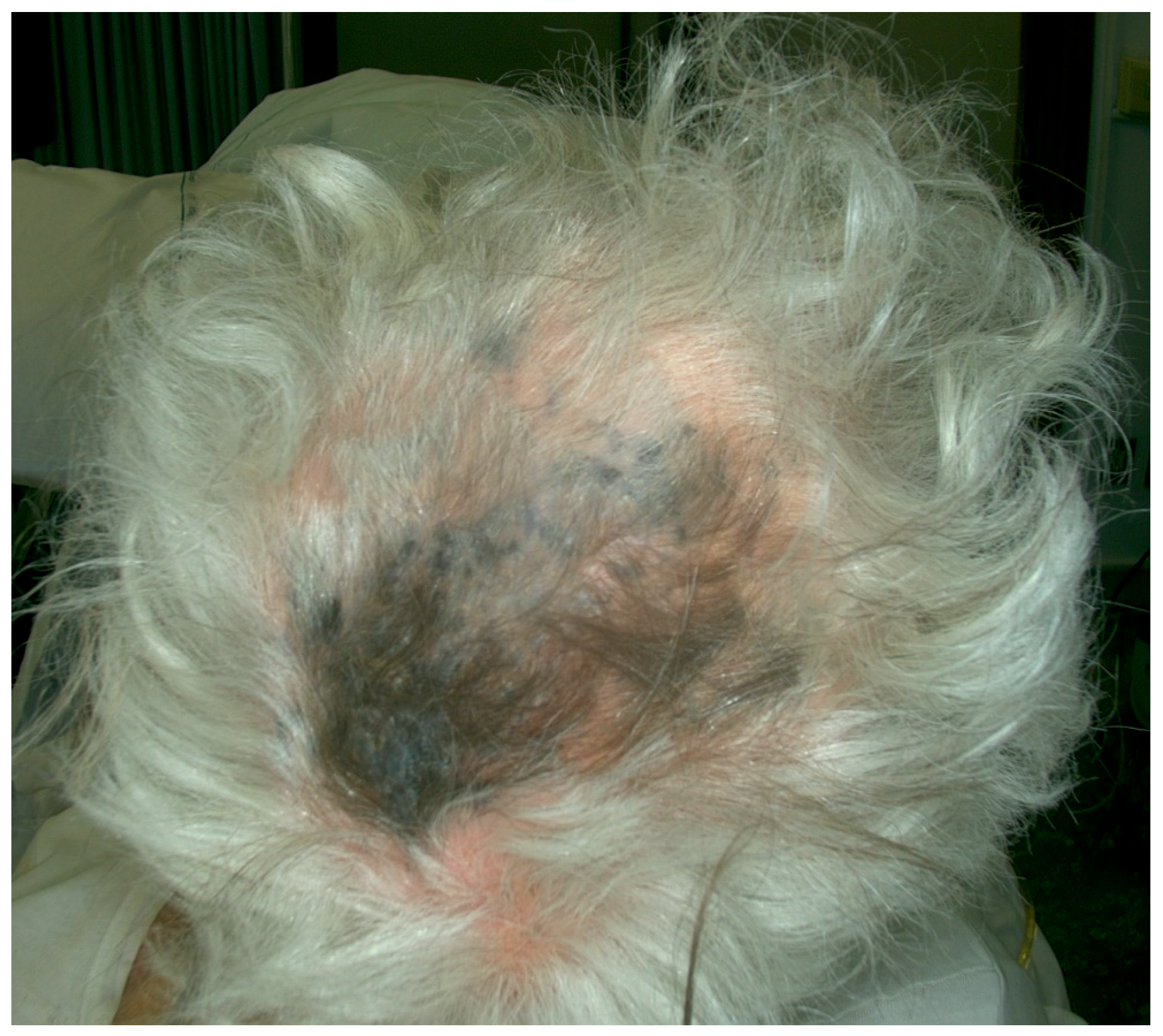 Jcm 13 00894 g006 Jcm 13 00894 g006