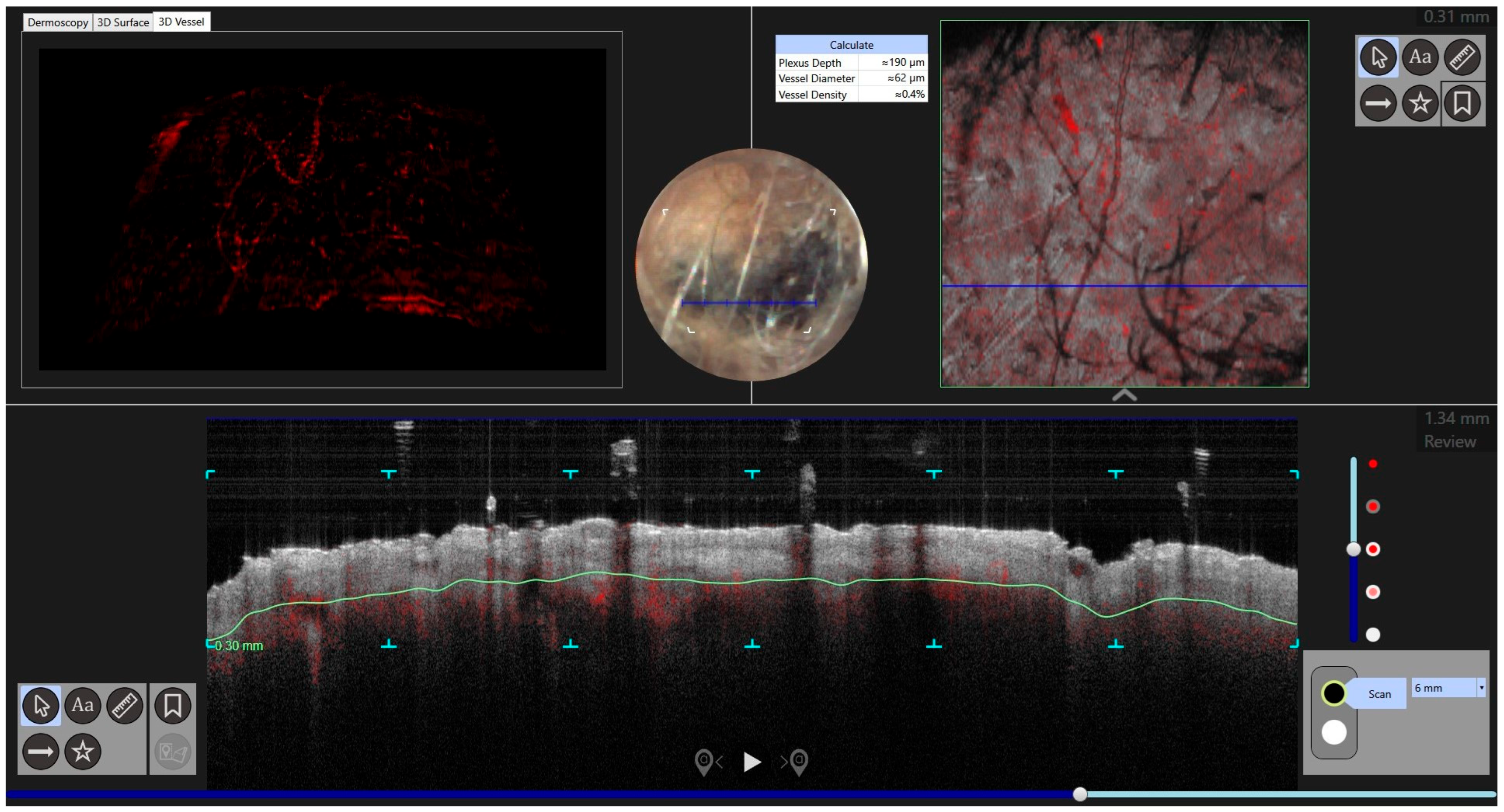 Jcm 13 00894 g008 Jcm 13 00894 g008