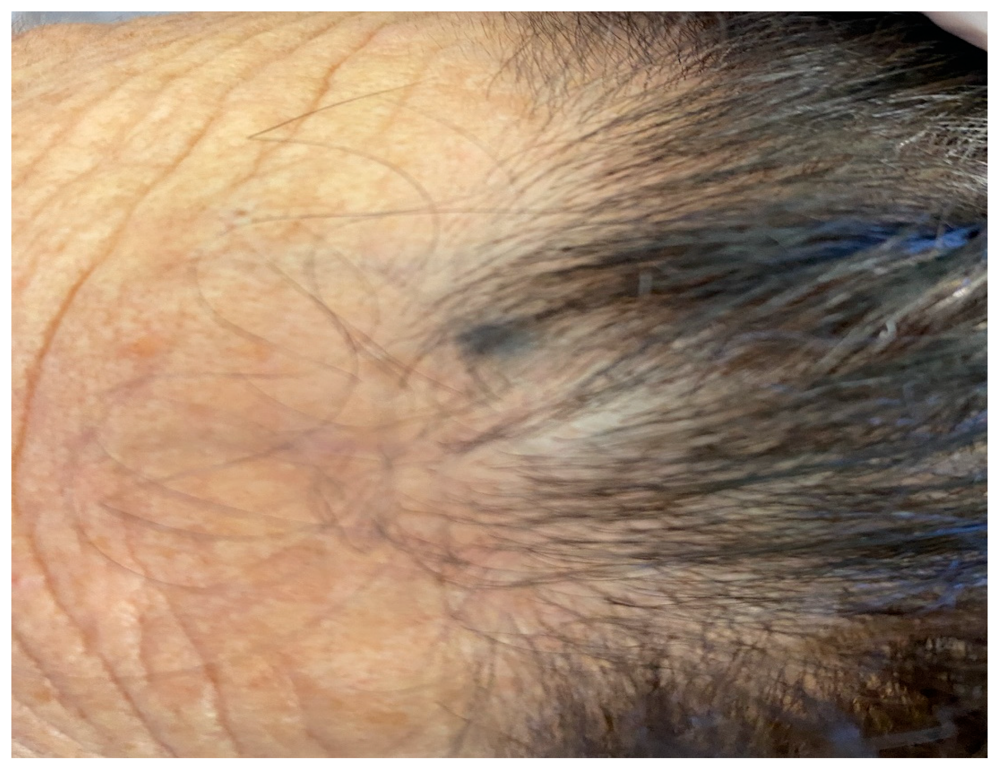 Jcm 13 00894 g011 Jcm 13 00894 g011