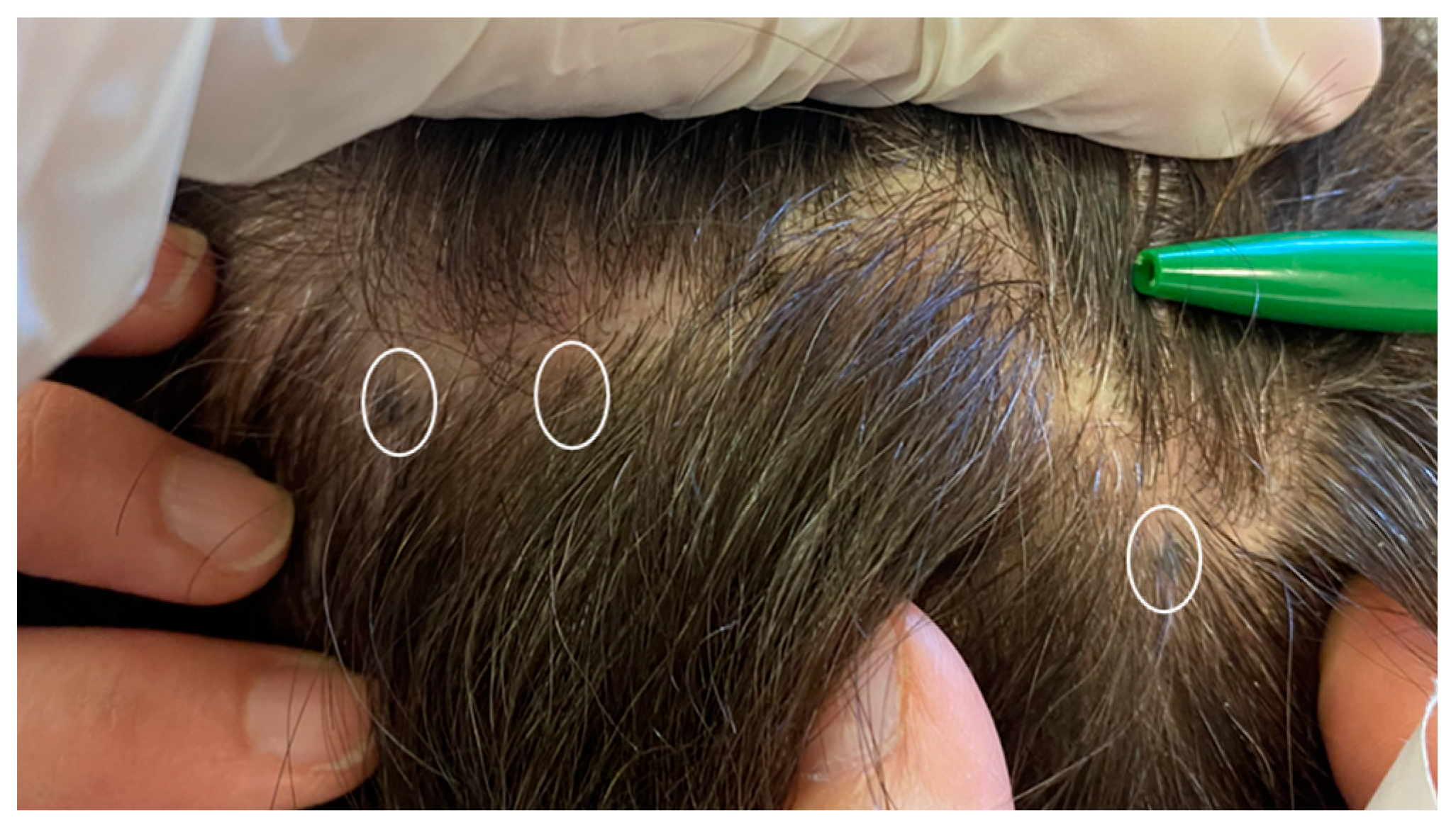 Jcm 13 00894 g012 Jcm 13 00894 g012