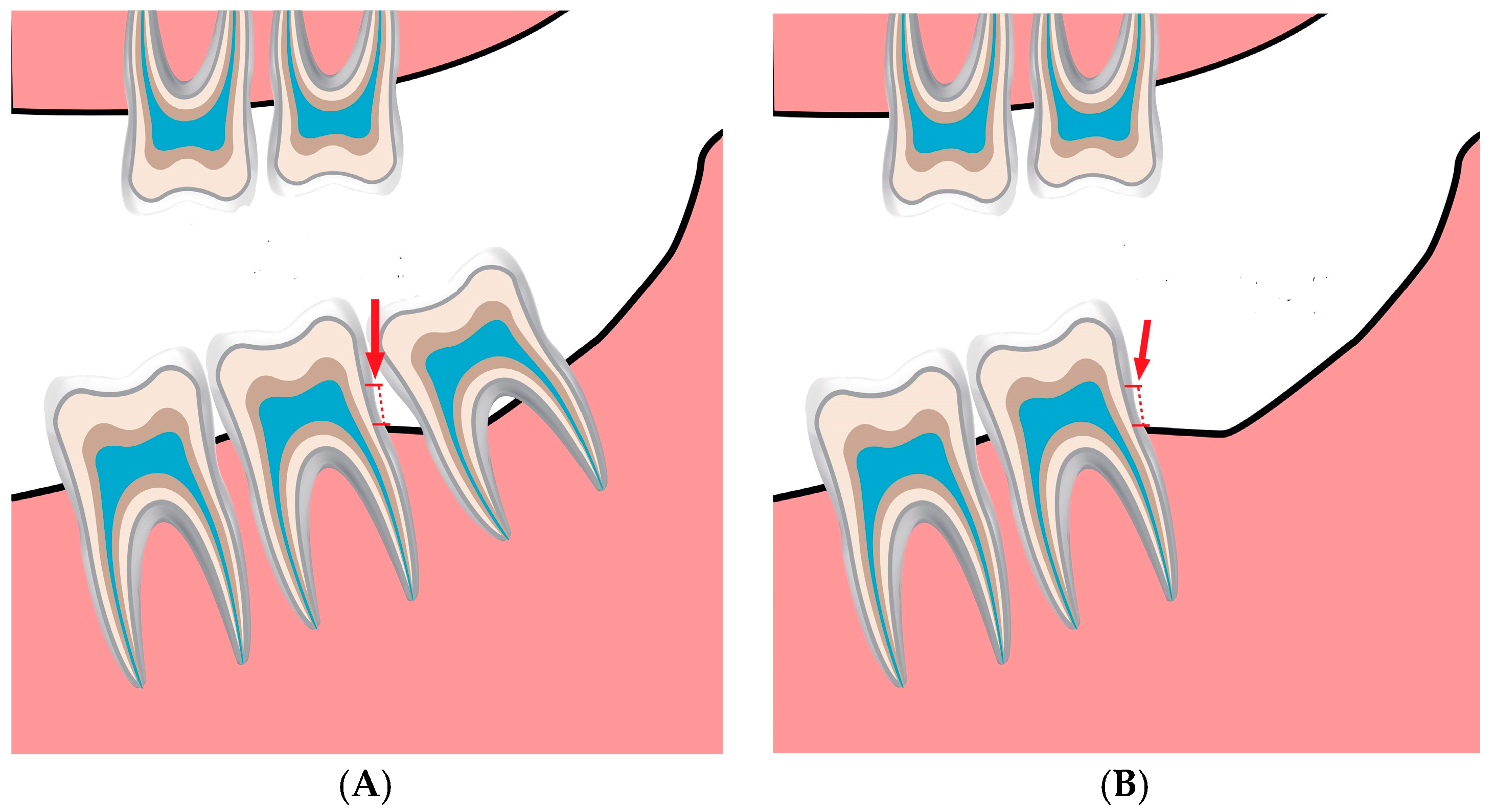 Jcm 13 00906 g001 Jcm 13 00906 g001
