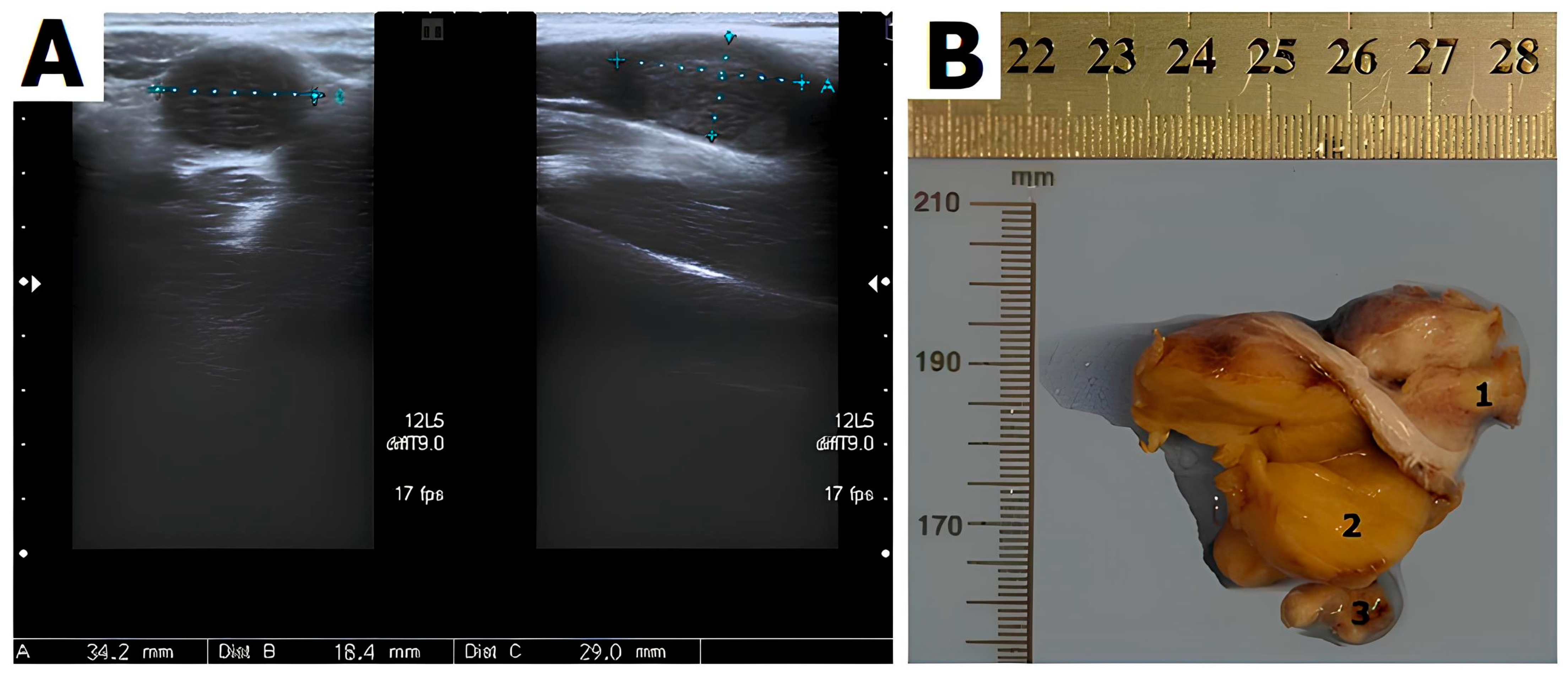 Jcm 13 00929 g001 Jcm 13 00929 g001