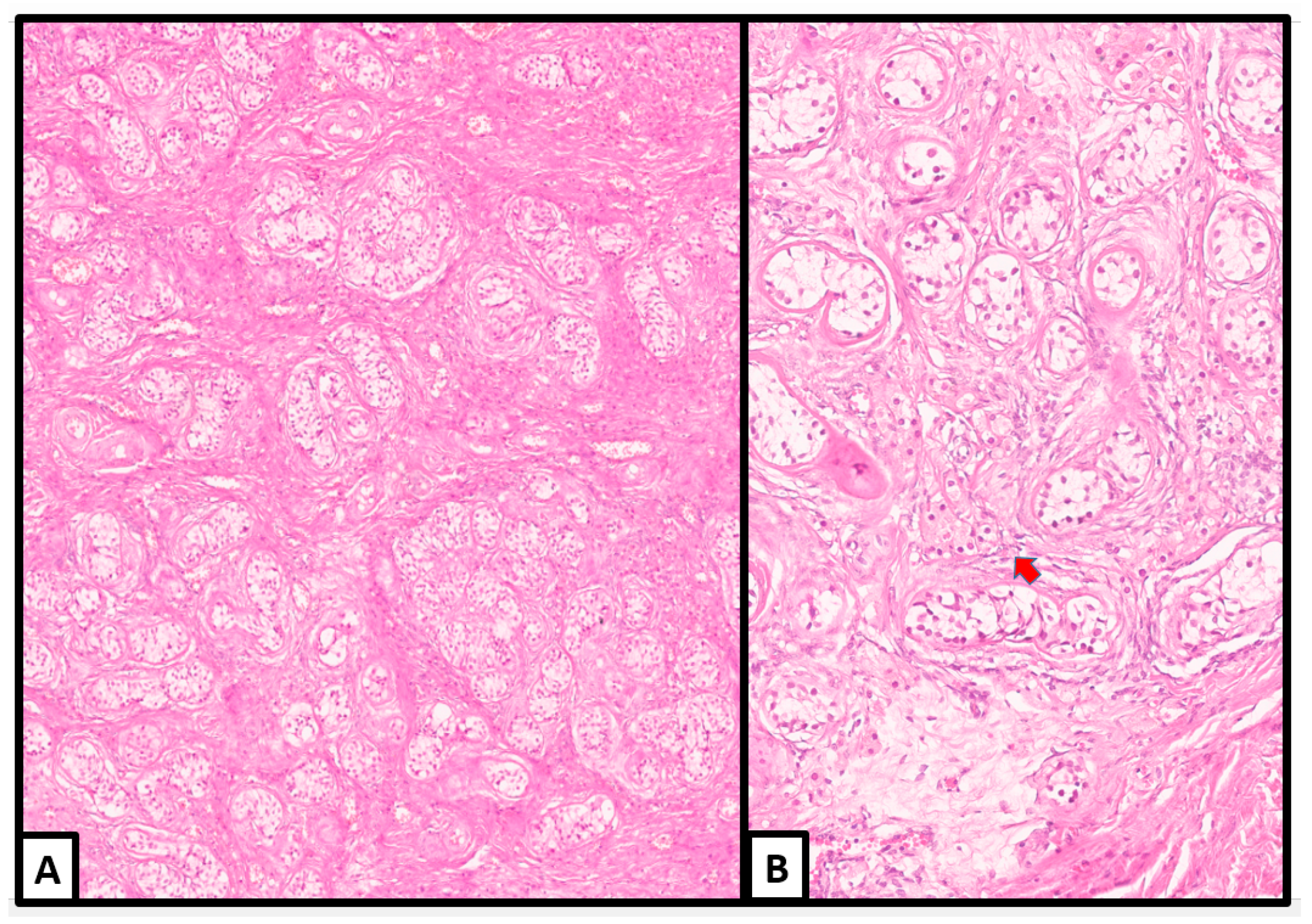 Jcm 13 00929 g003 Jcm 13 00929 g003