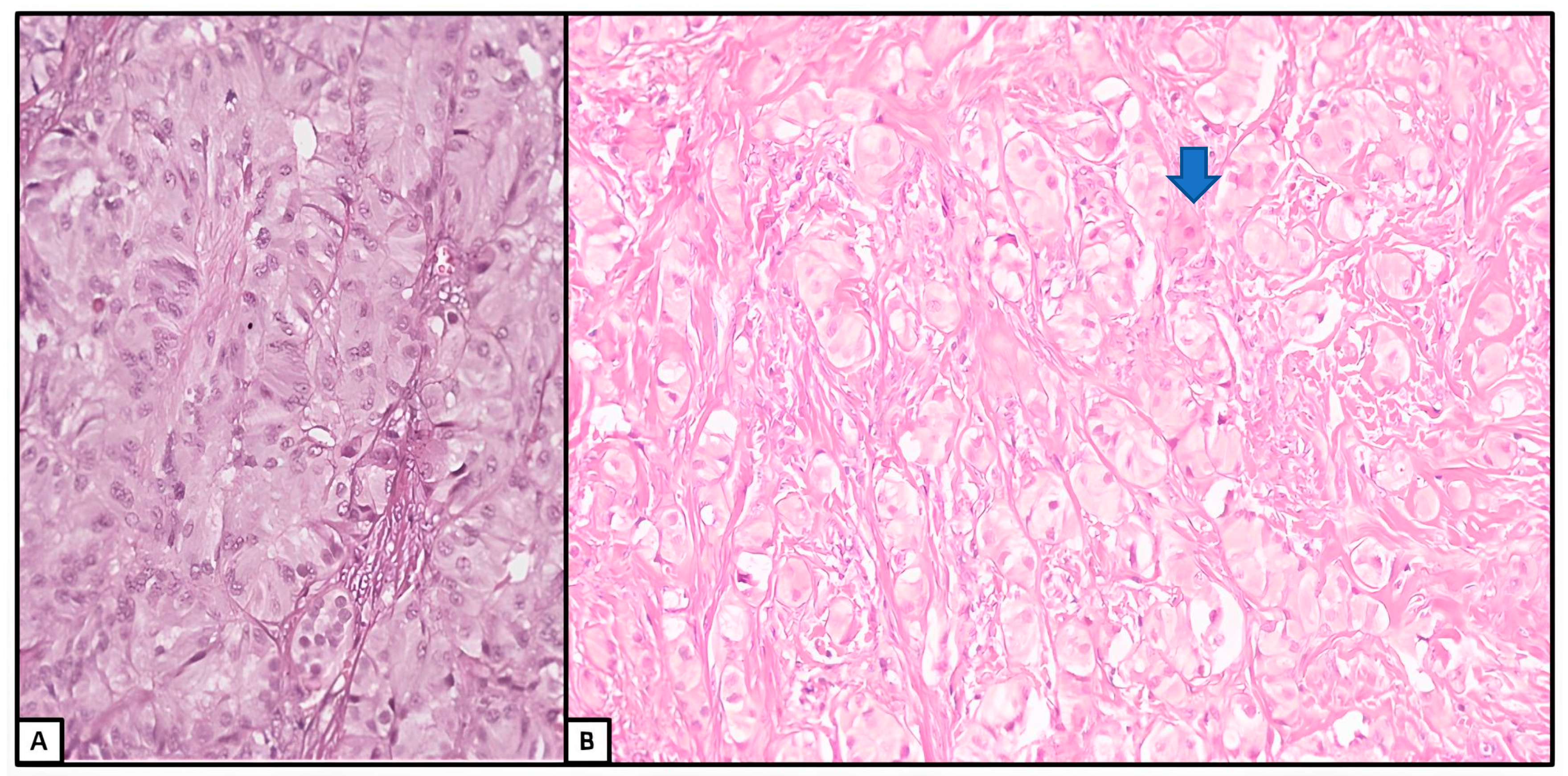 Jcm 13 00929 g007 Jcm 13 00929 g007