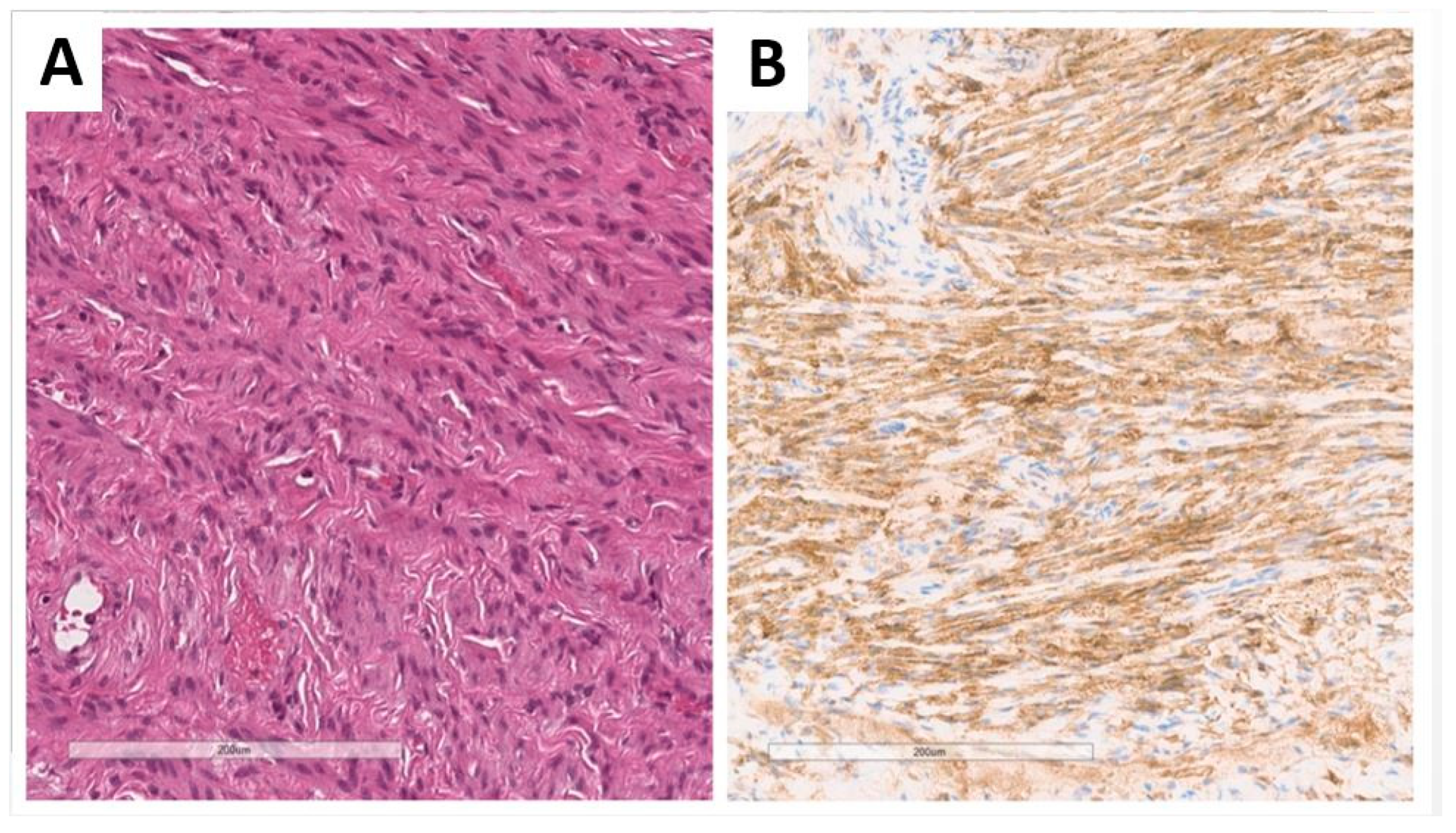 Jcm 13 00929 g009 Jcm 13 00929 g009