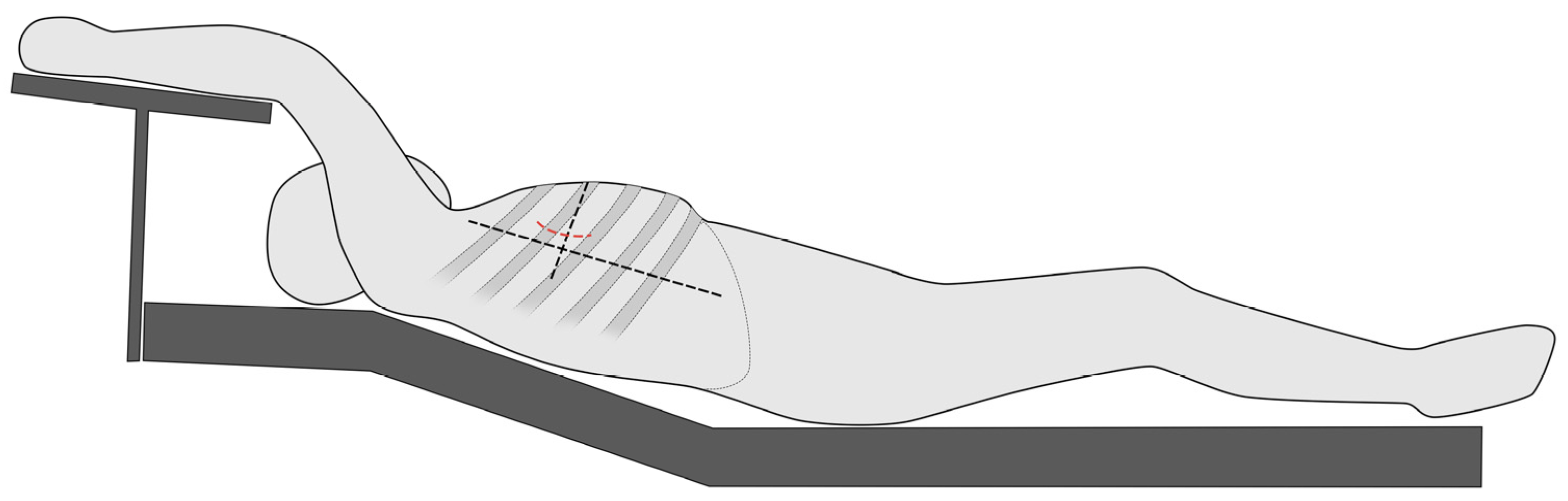 Jcm 13 00985 g002 Jcm 13 00985 g002