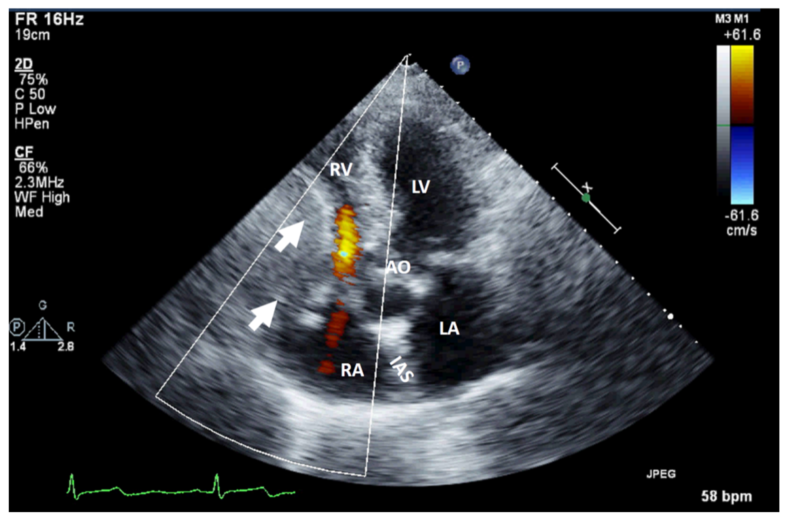 Jcm 13 01000 g001 Jcm 13 01000 g001
