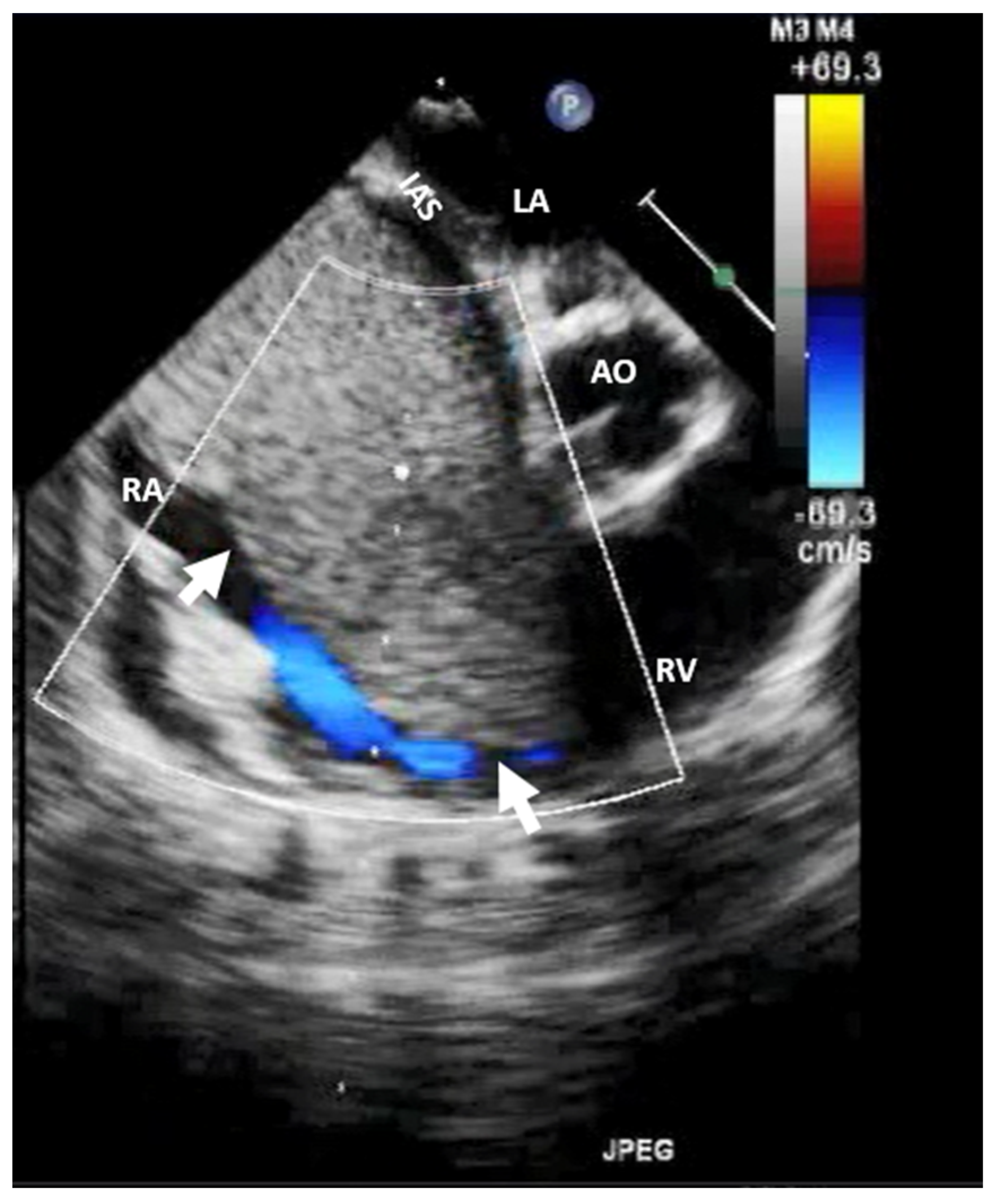 Jcm 13 01000 g002 Jcm 13 01000 g002