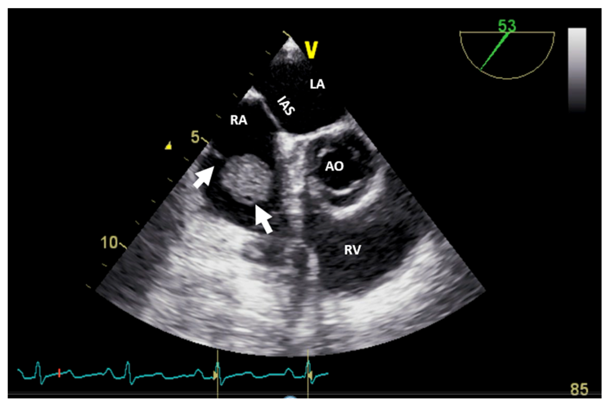 Jcm 13 01000 g005 Jcm 13 01000 g005
