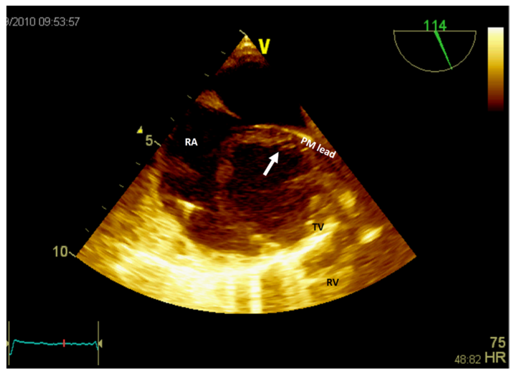 Jcm 13 01000 g006 Jcm 13 01000 g006