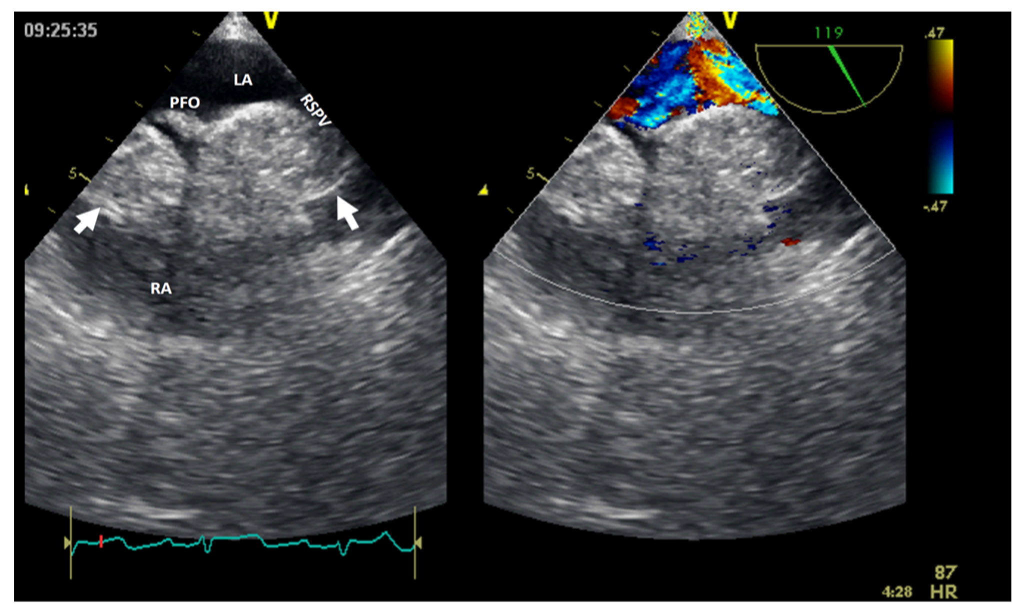 Jcm 13 01000 g007 Jcm 13 01000 g007