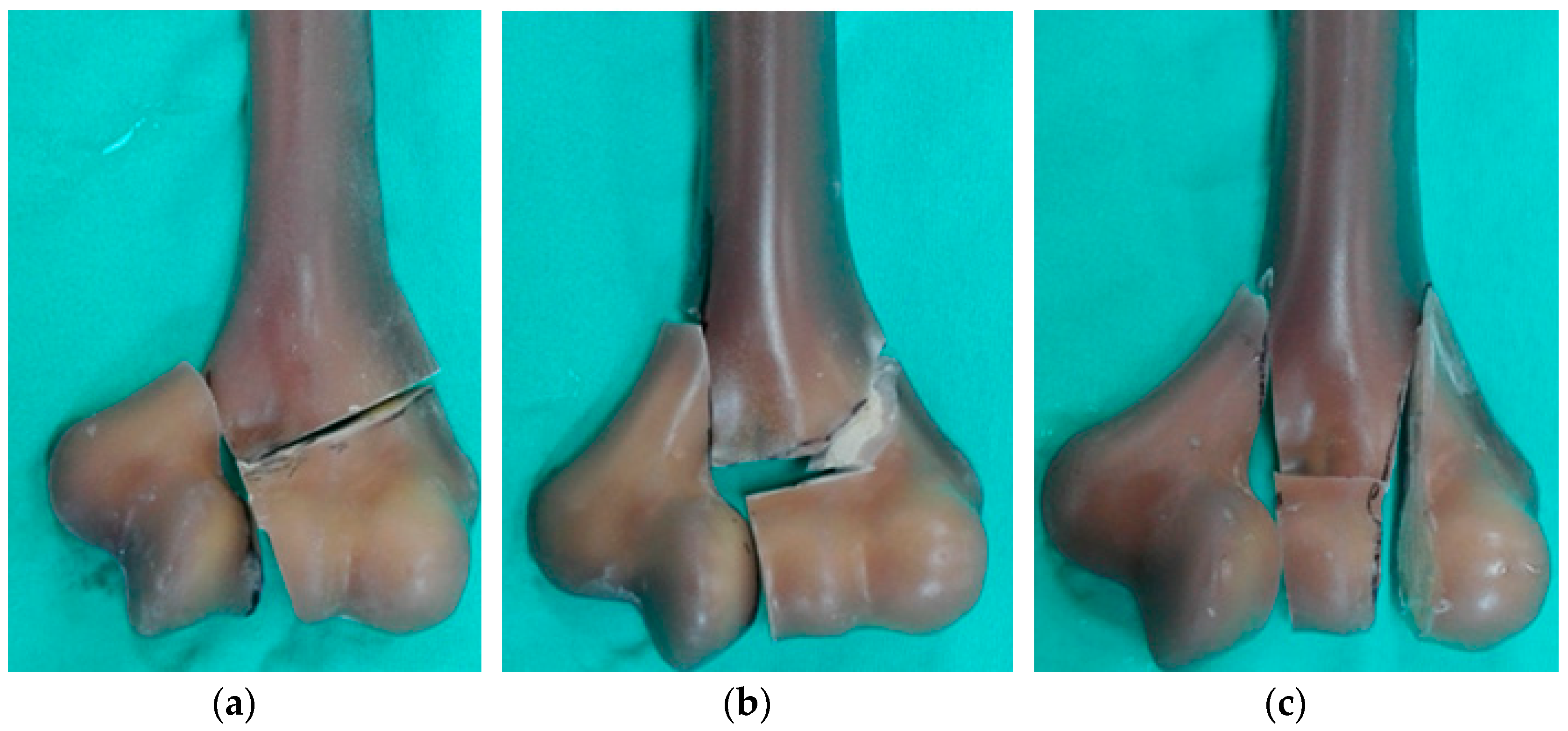 Jcm 13 01034 g002 Jcm 13 01034 g002