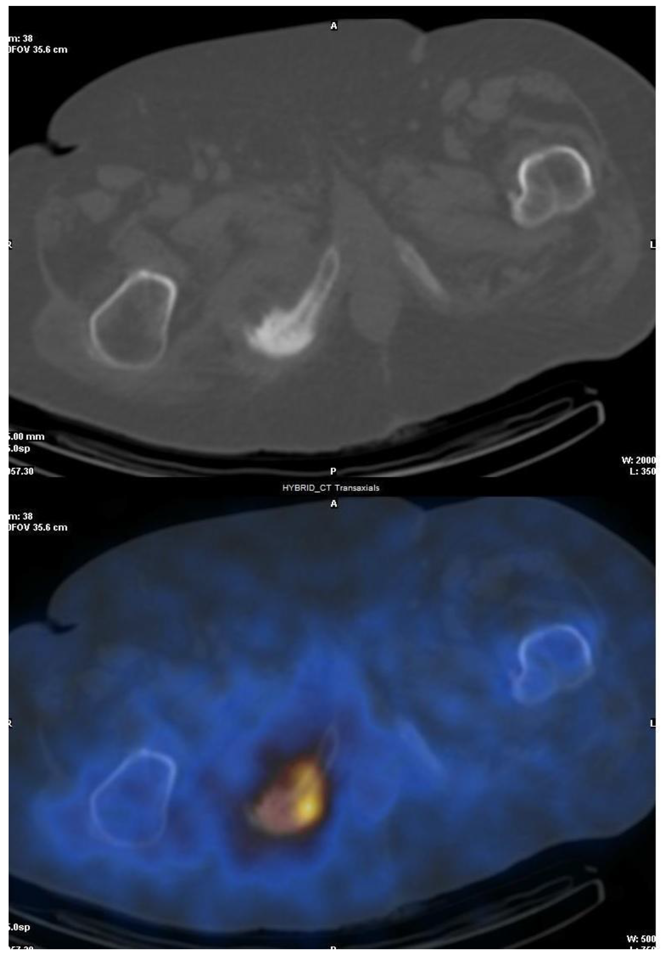 Jcm 13 01058 g001 Jcm 13 01058 g001