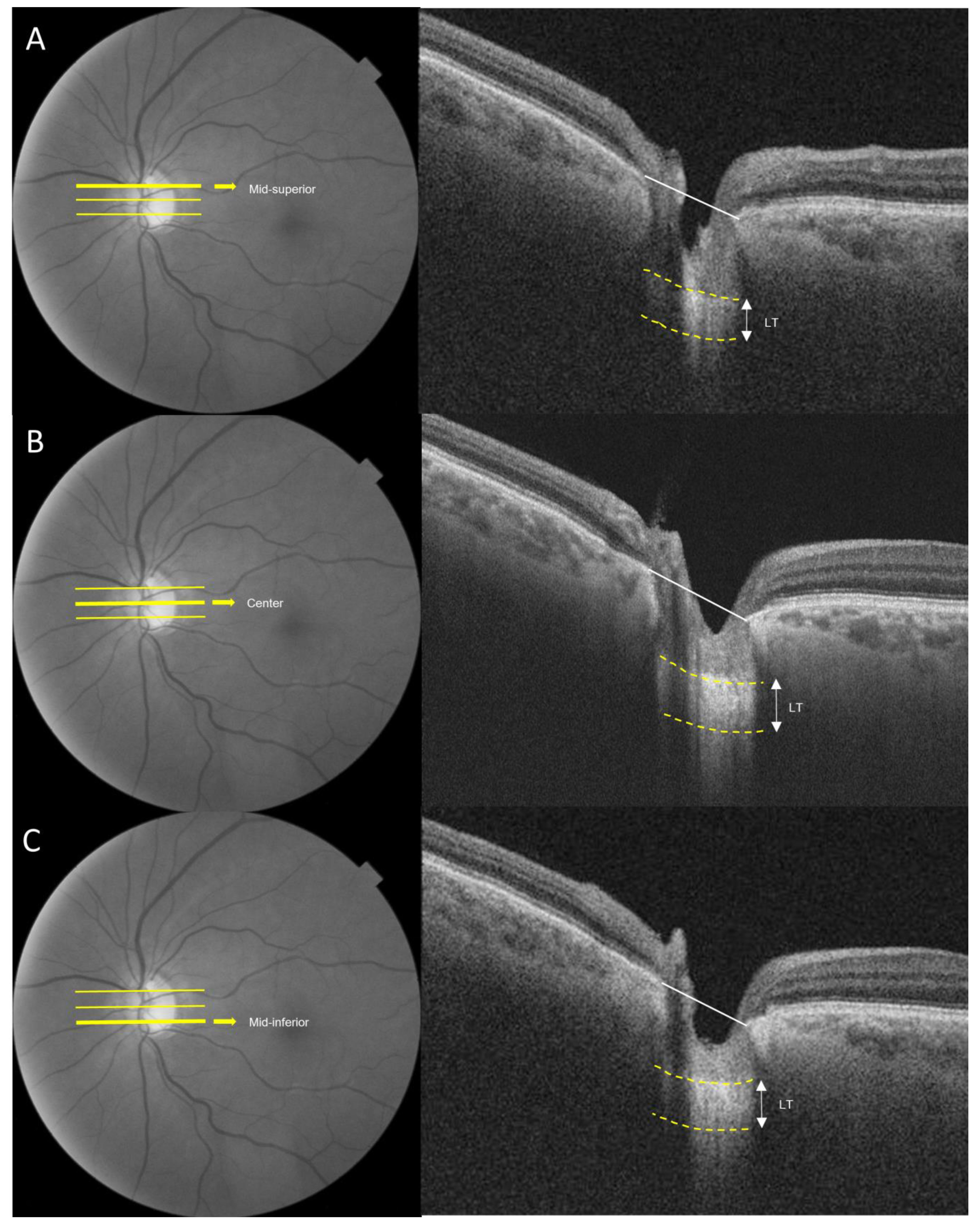 Jcm 13 01078 g001 Jcm 13 01078 g001