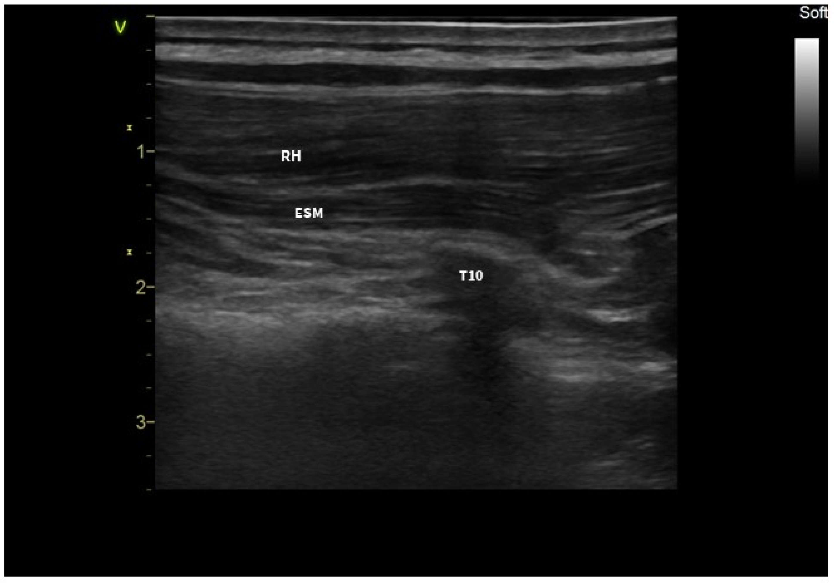Jcm 13 01128 g001 Jcm 13 01128 g001