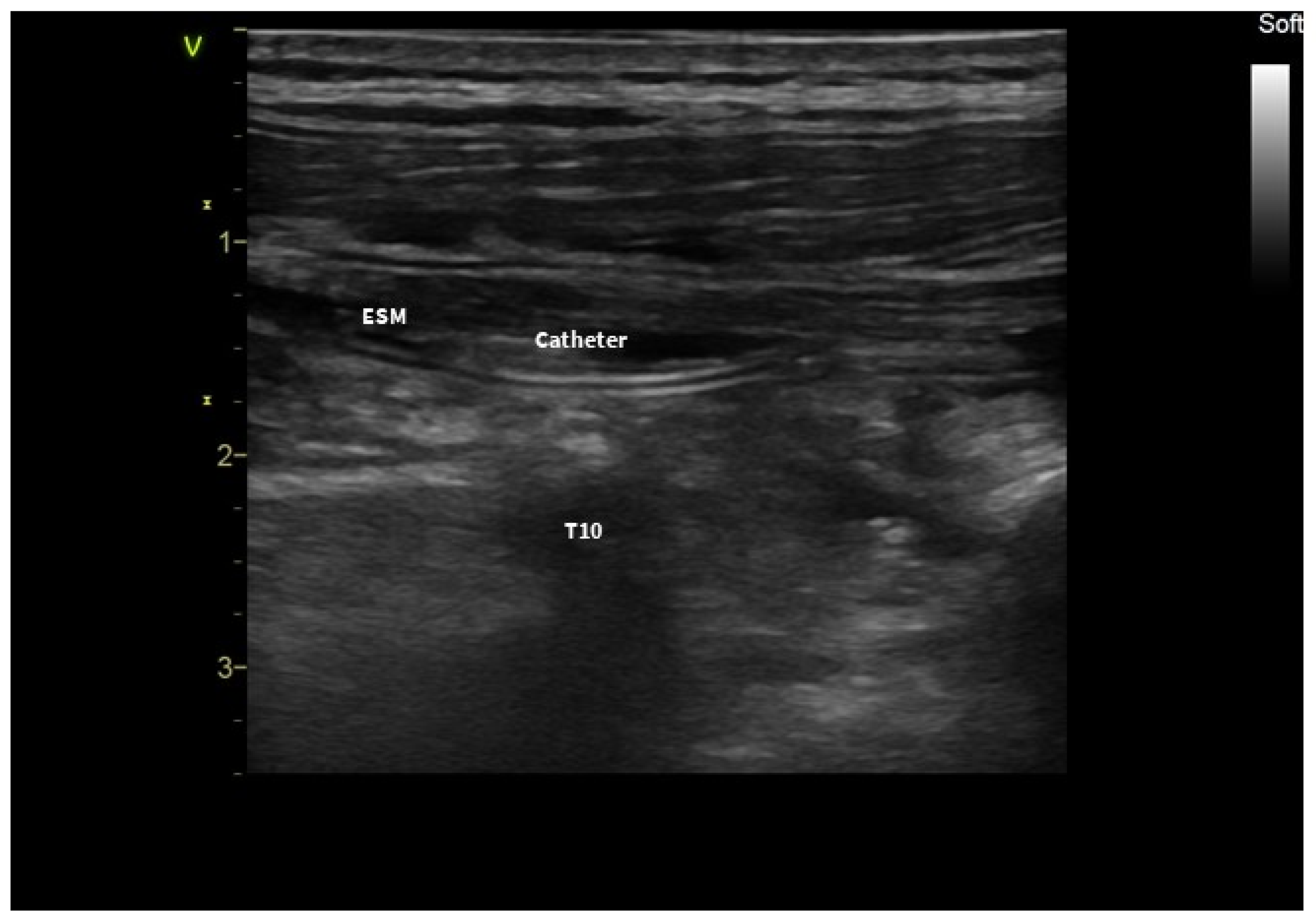 Jcm 13 01128 g002 Jcm 13 01128 g002