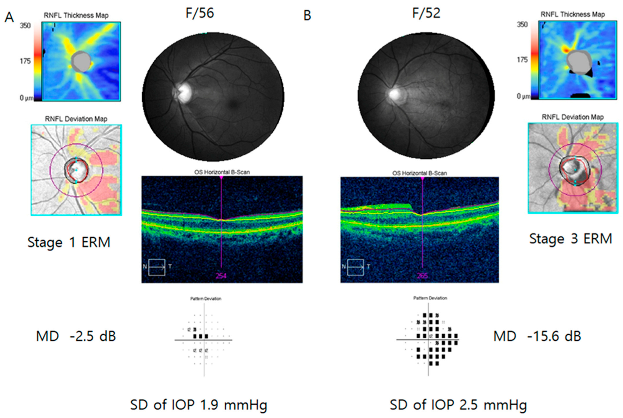 Jcm 13 01138 g002 Jcm 13 01138 g002