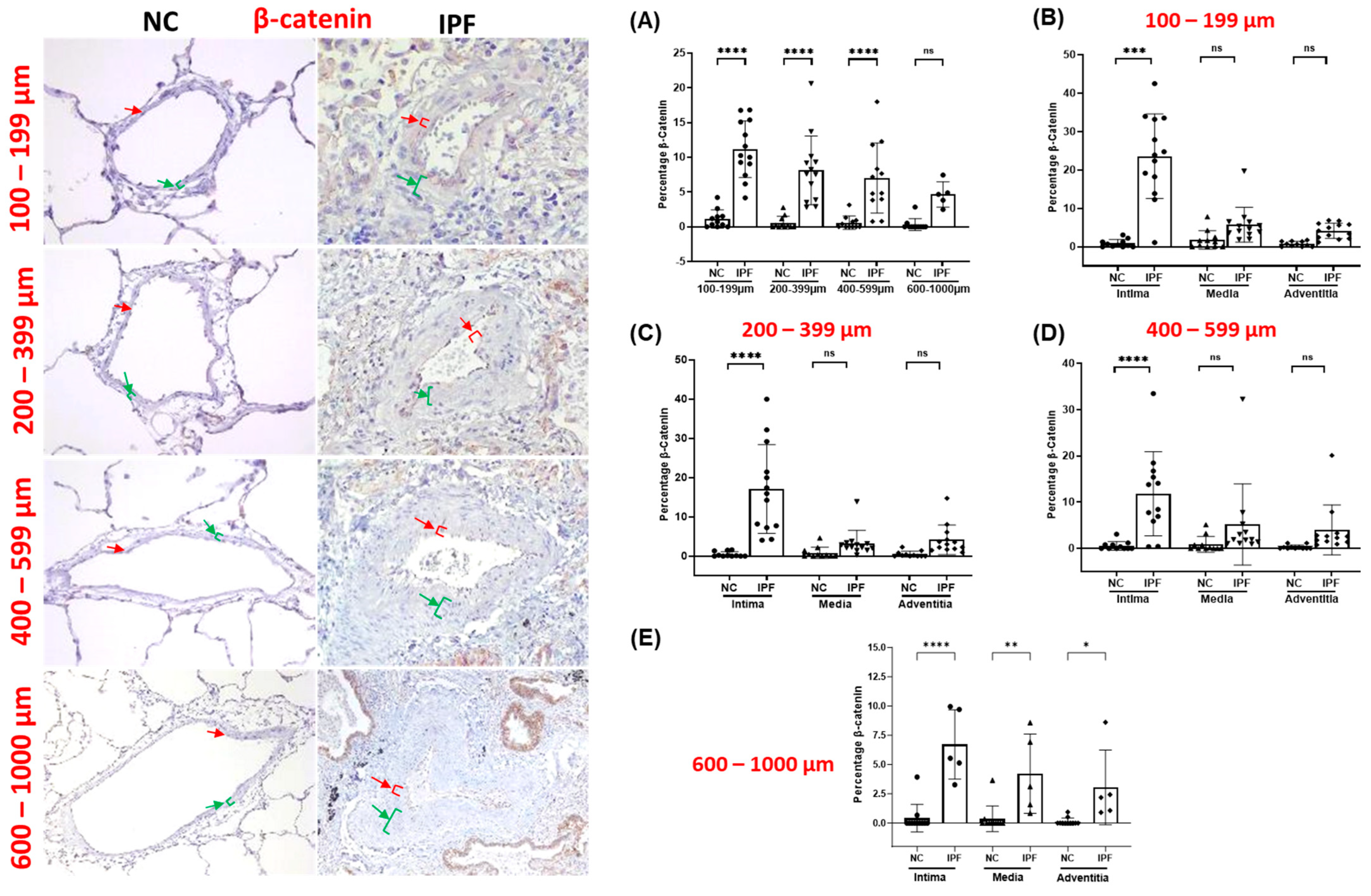 Jcm 13 01160 g005 Jcm 13 01160 g005