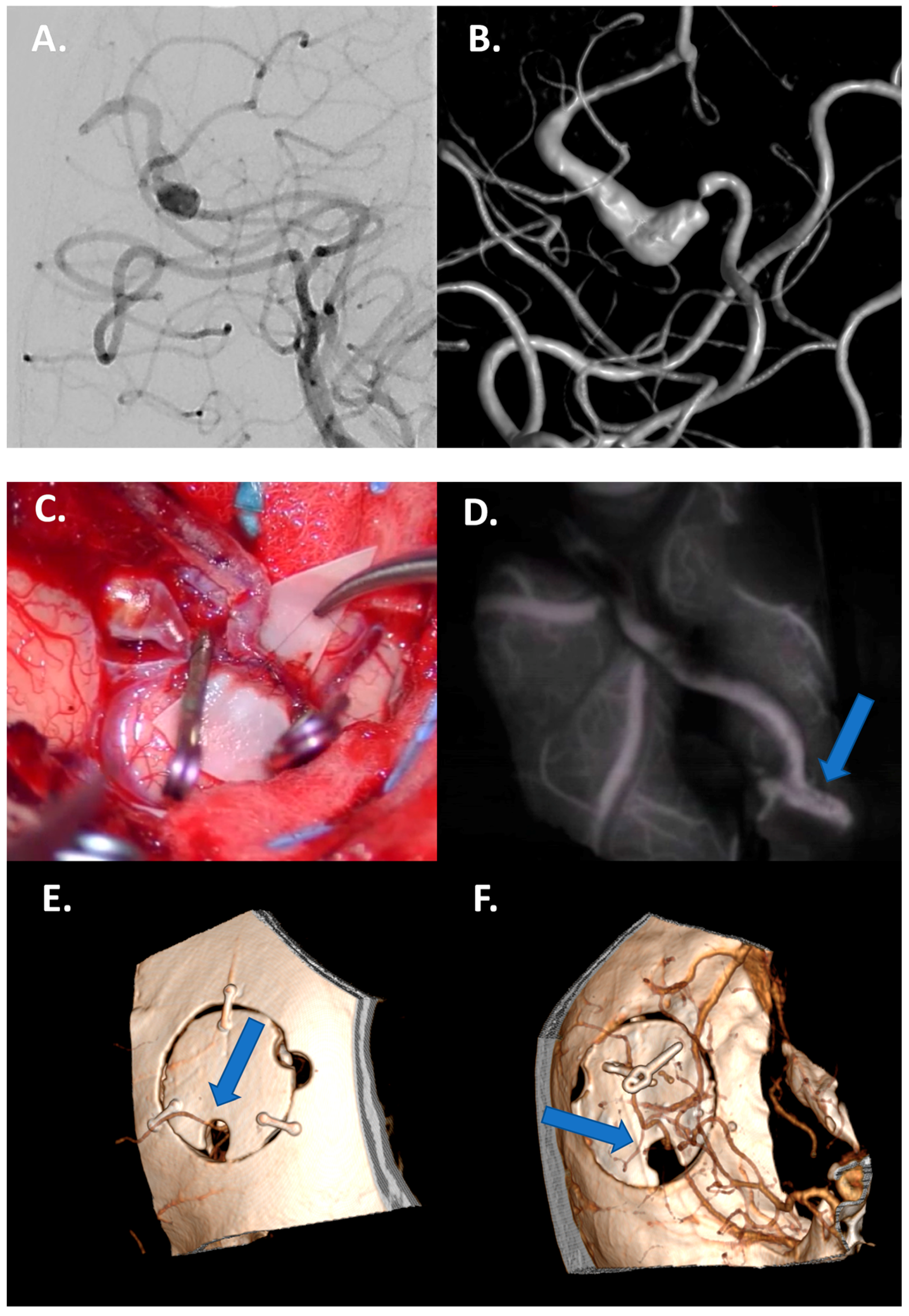 Jcm 13 01286 g002 Jcm 13 01286 g002