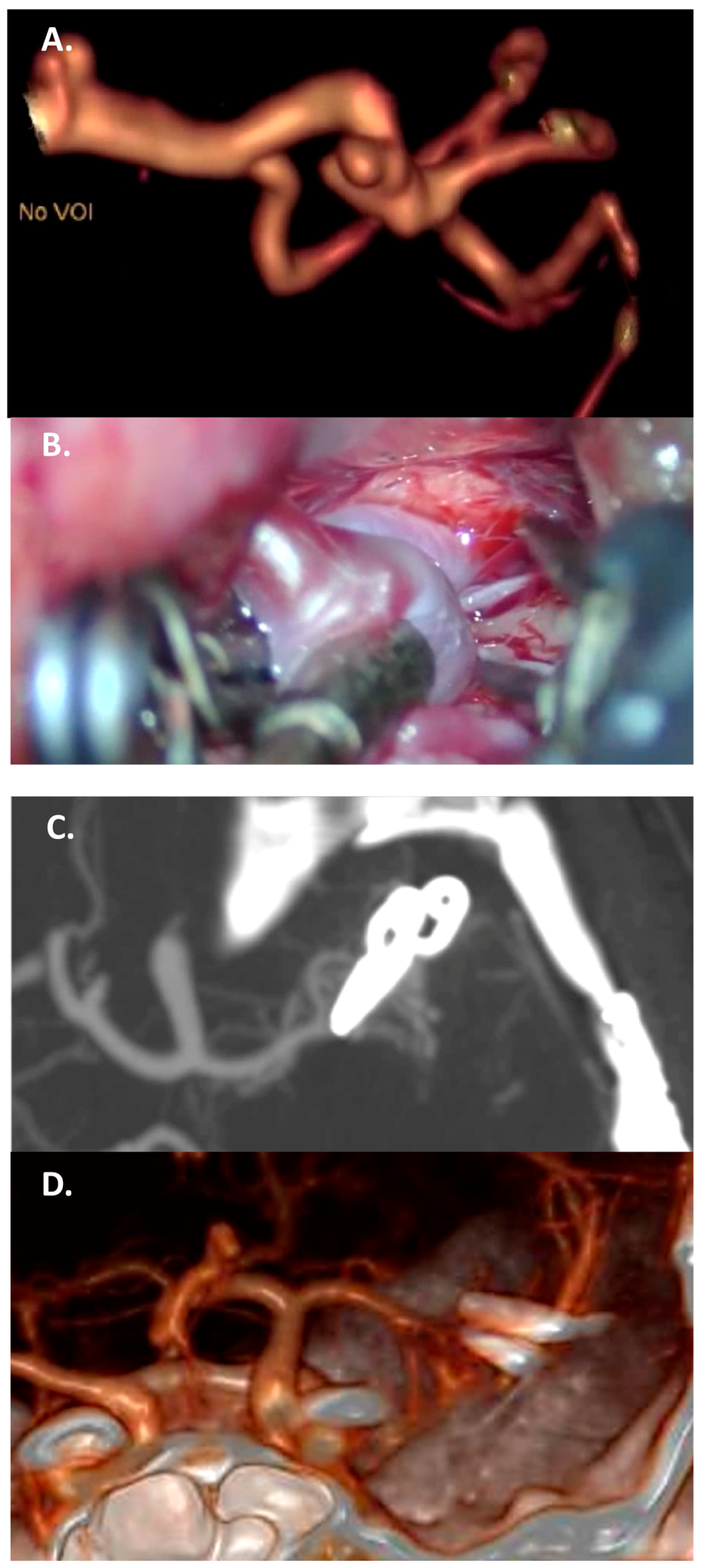 Jcm 13 01286 g004 Jcm 13 01286 g004