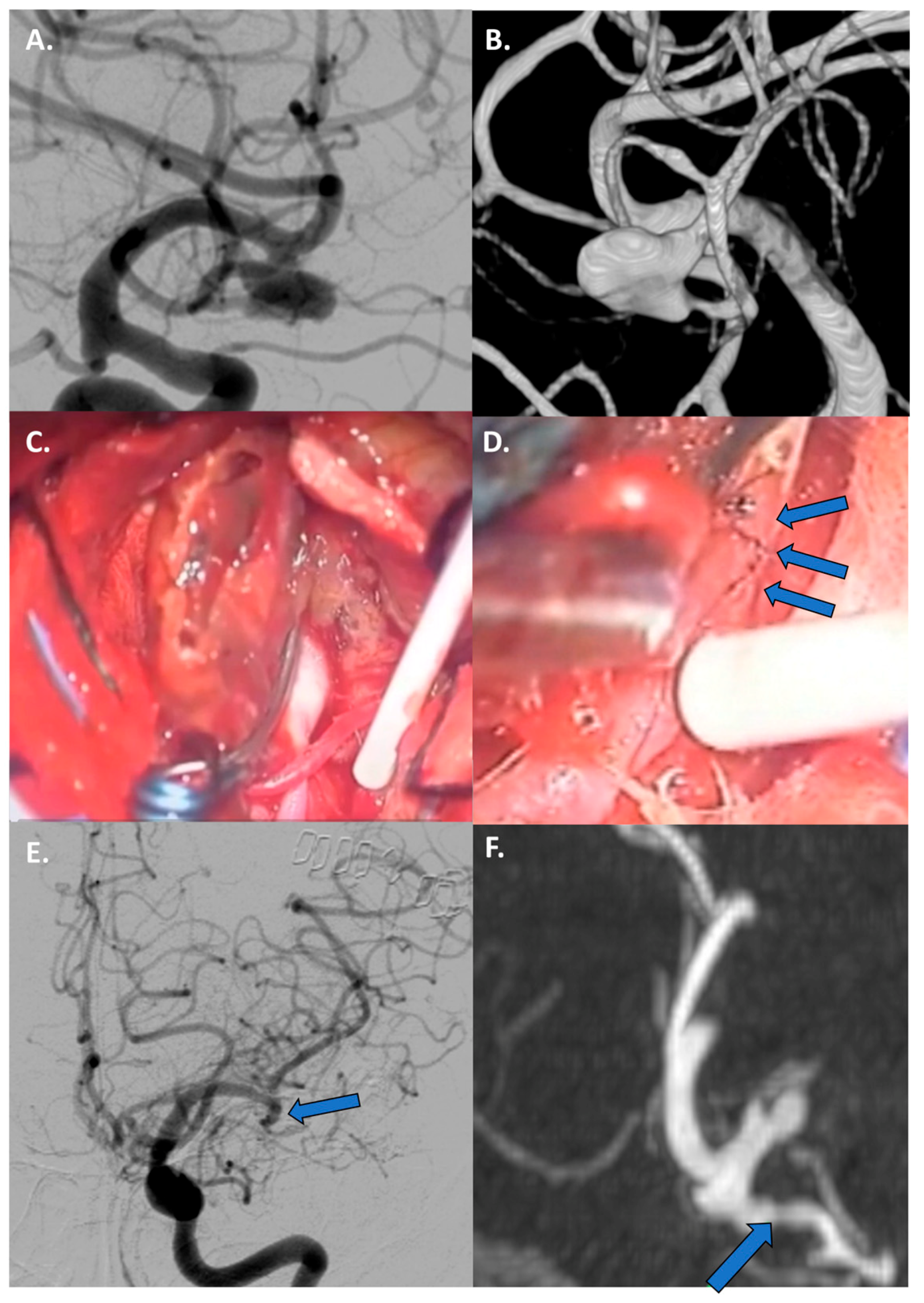 Jcm 13 01286 g006 Jcm 13 01286 g006