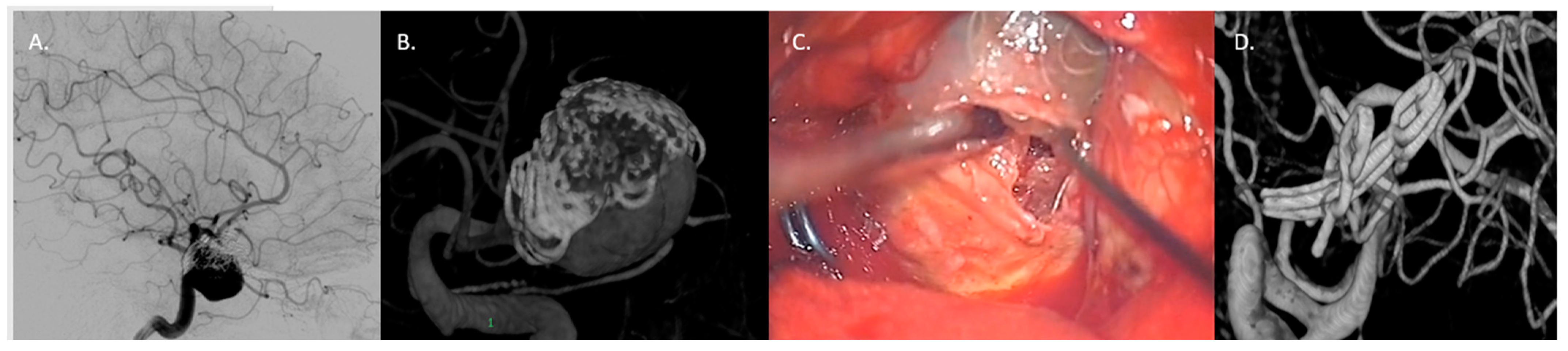 Jcm 13 01286 g007 Jcm 13 01286 g007