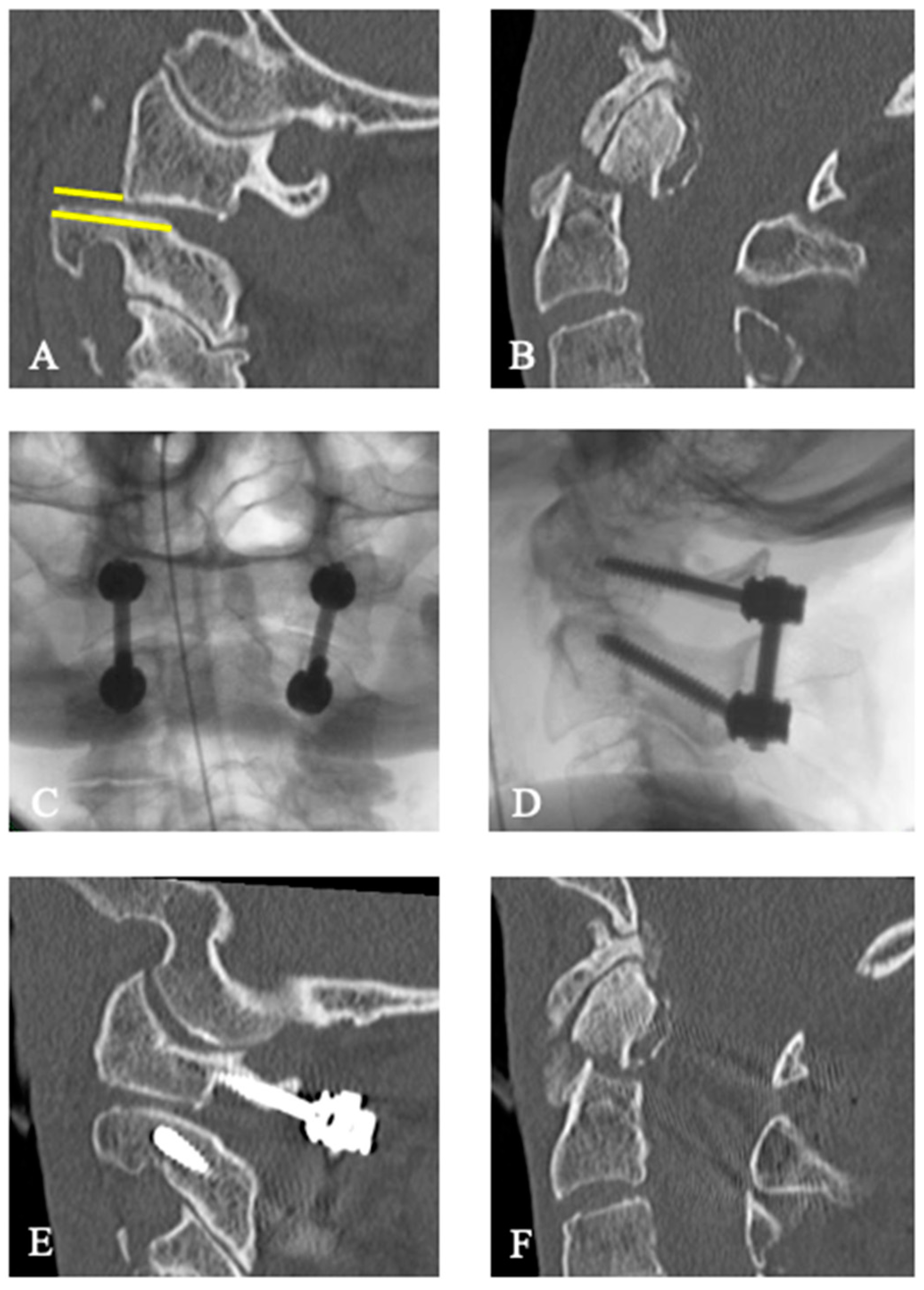 Jcm 13 01326 g002 Jcm 13 01326 g002
