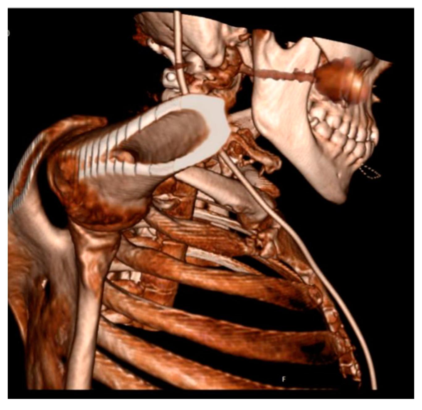 Jcm 13 01366 g001 Jcm 13 01366 g001