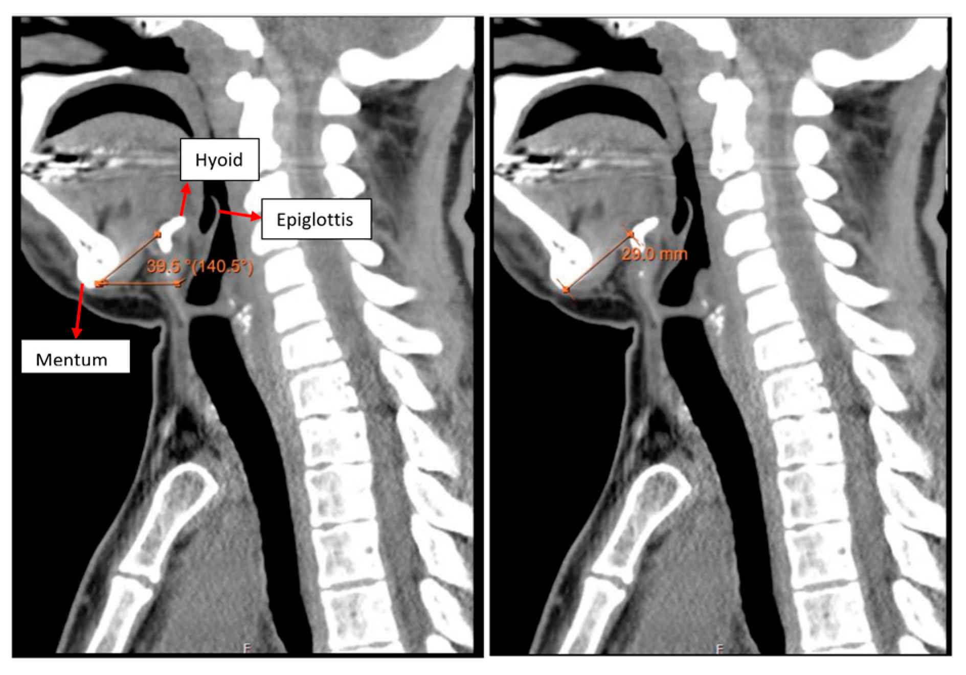 Jcm 13 01366 g002 Jcm 13 01366 g002