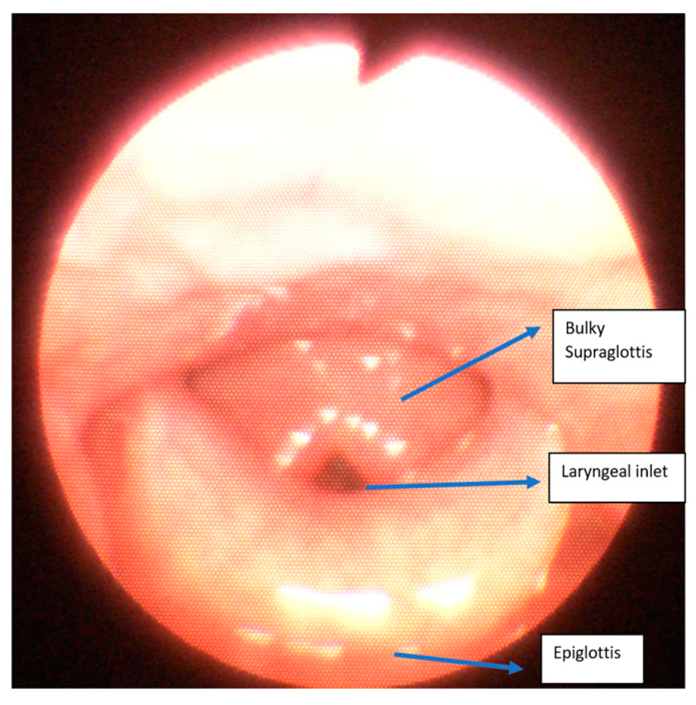 Jcm 13 01366 g003 Jcm 13 01366 g003
