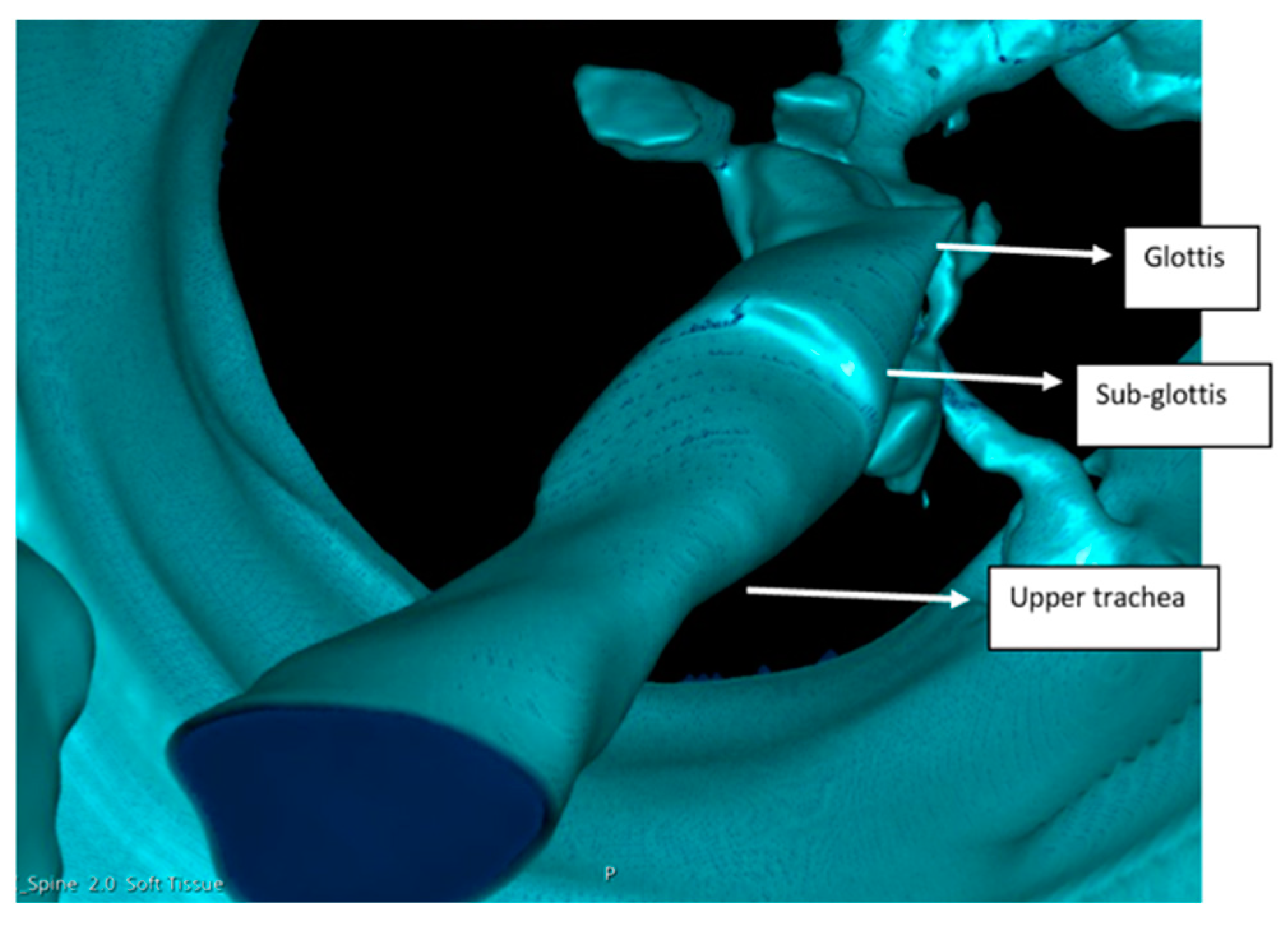 Jcm 13 01366 g004 Jcm 13 01366 g004