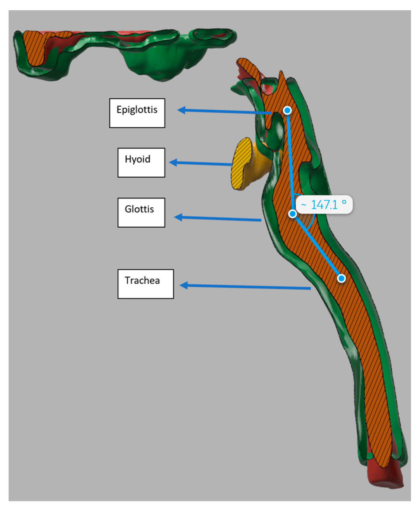 Jcm 13 01366 g007 Jcm 13 01366 g007
