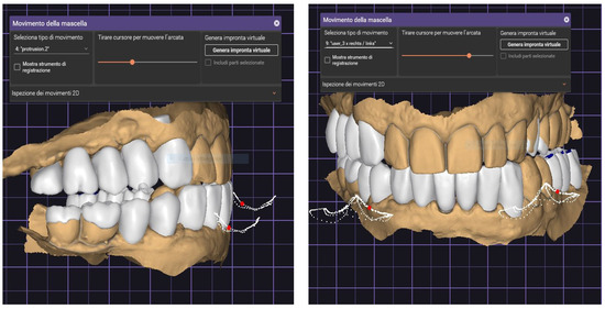 RESTORATIVE DESIGN & PRACTICAL OCCLUSIO… Digital Protocol to Record Occlusal Analysis in Prosthodontics: A