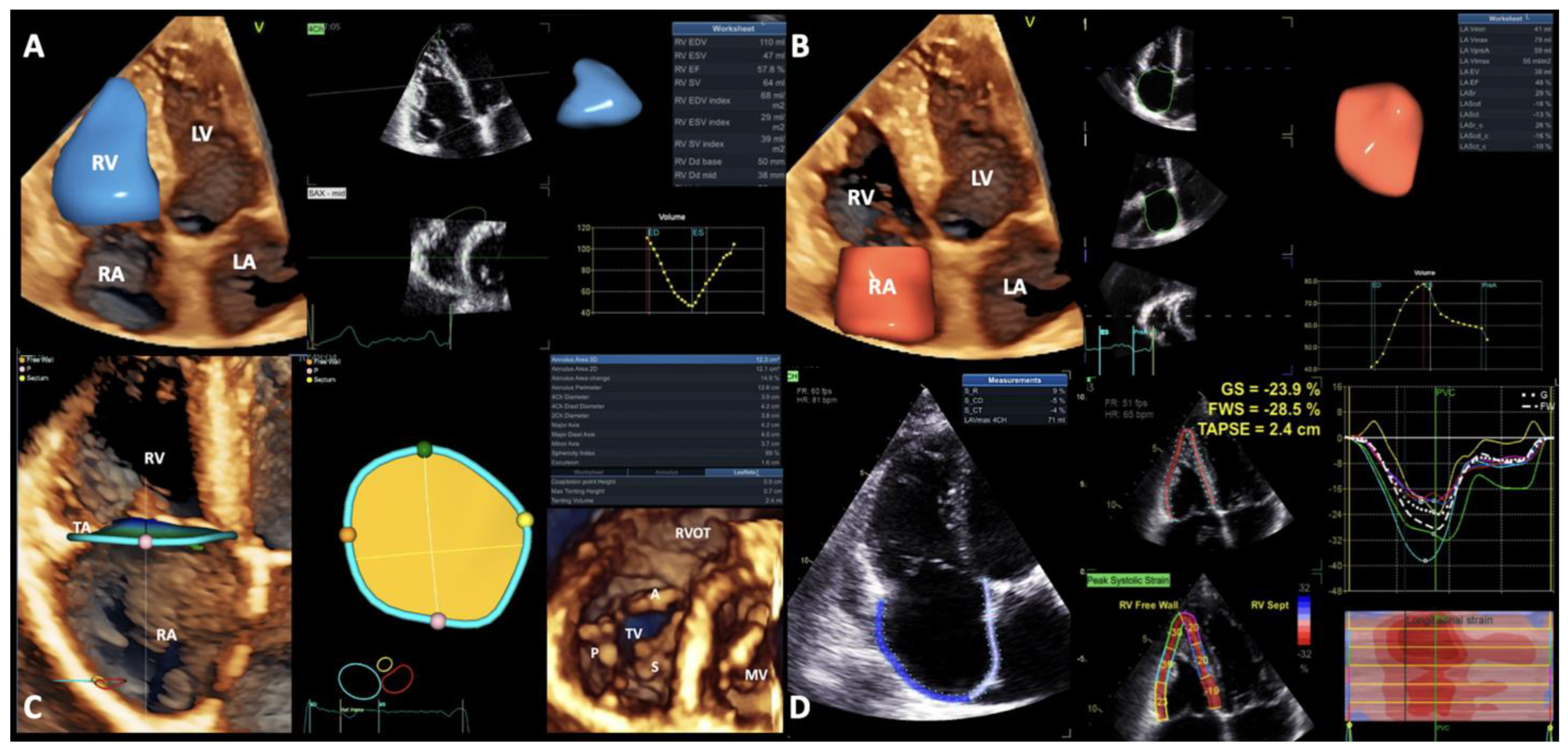 Jcm 13 01400 g001 Jcm 13 01400 g001