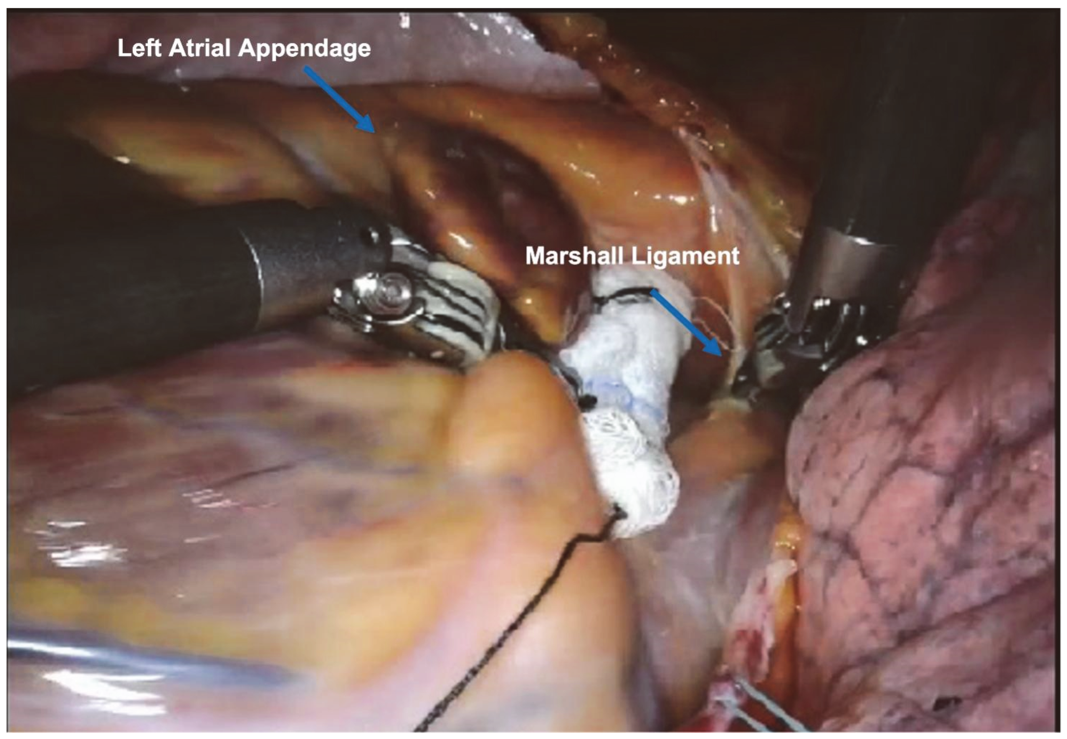 Jcm 13 01563 g002 Jcm 13 01563 g002