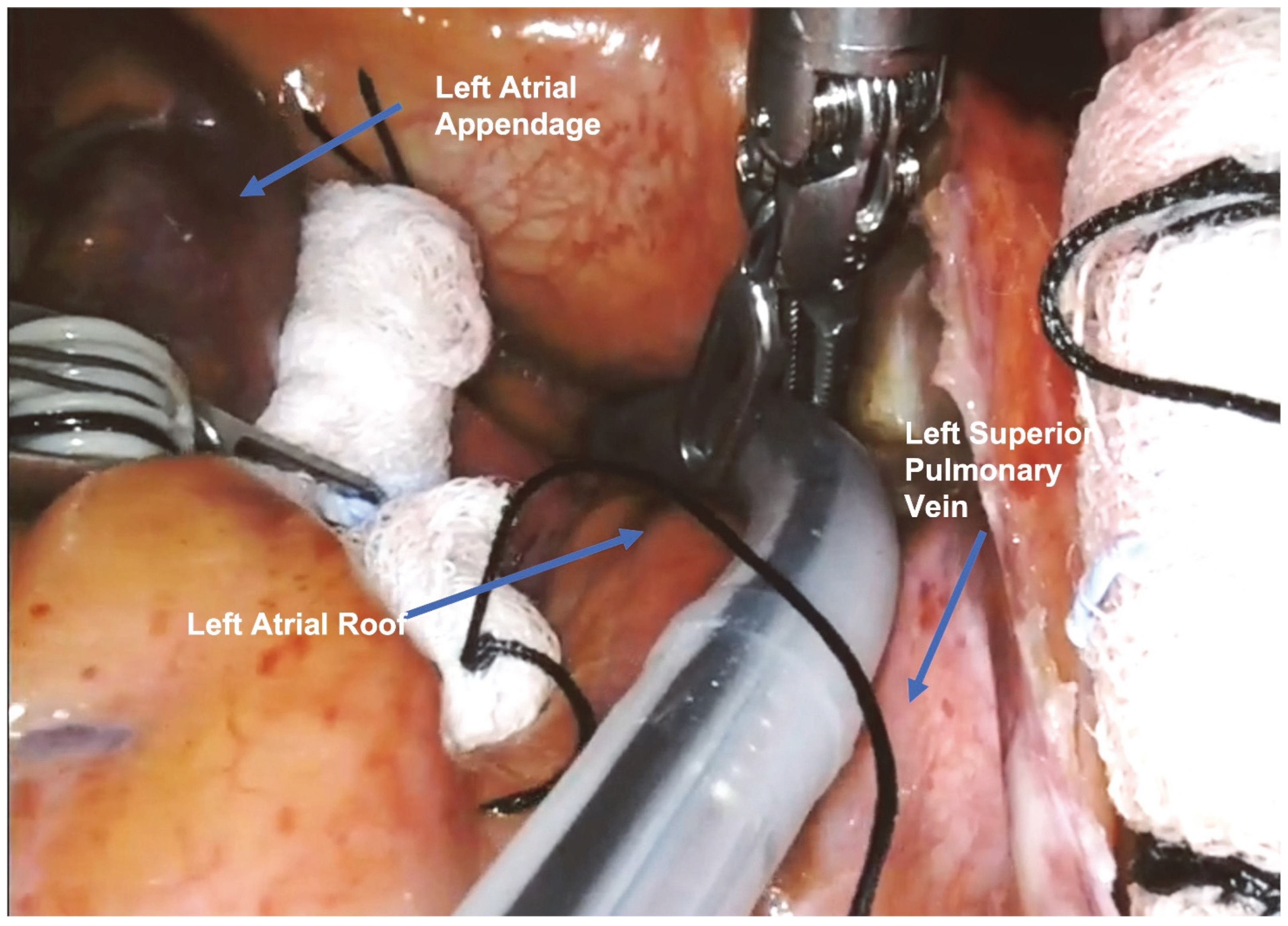 Jcm 13 01563 g003 Jcm 13 01563 g003