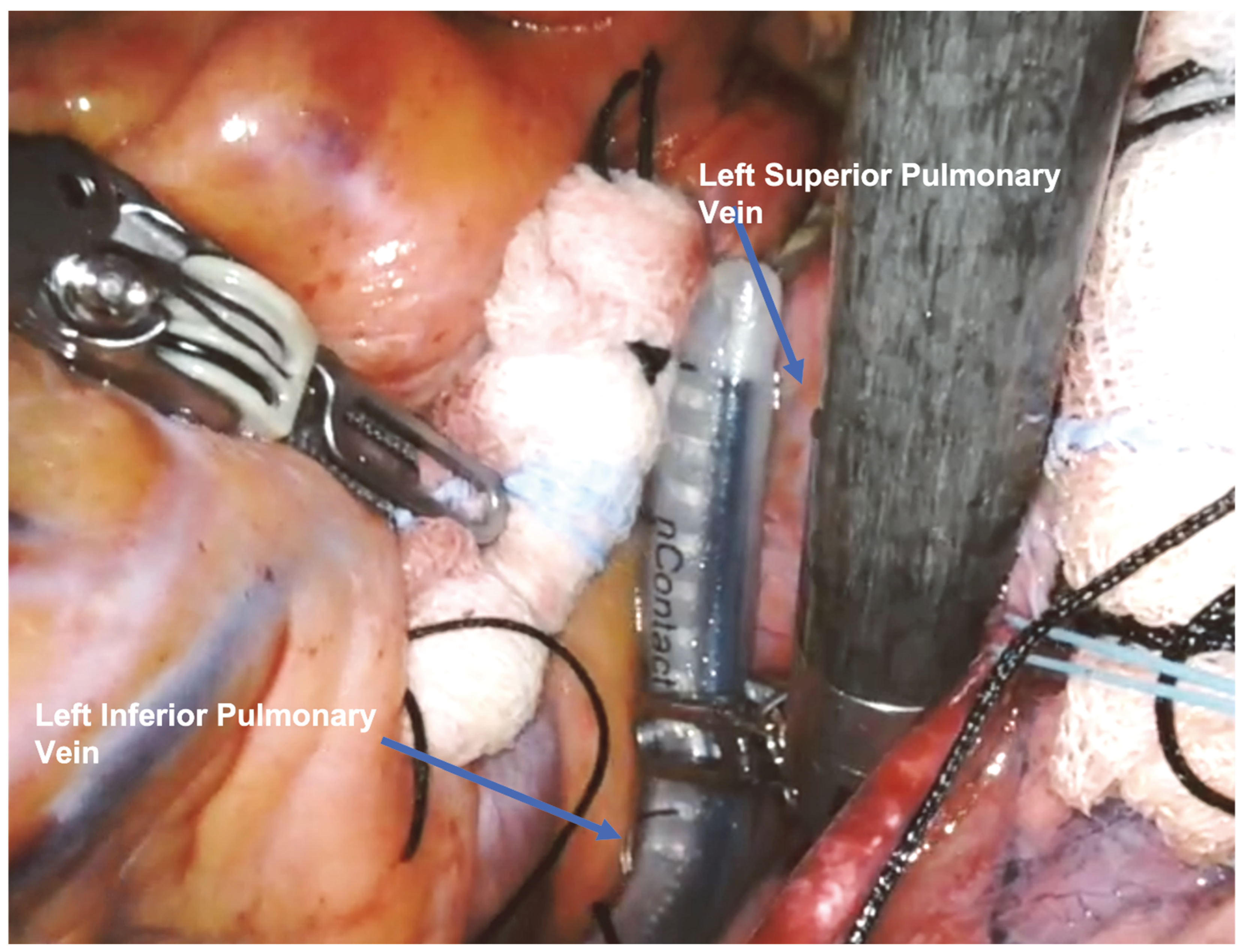 Jcm 13 01563 g004 Jcm 13 01563 g004